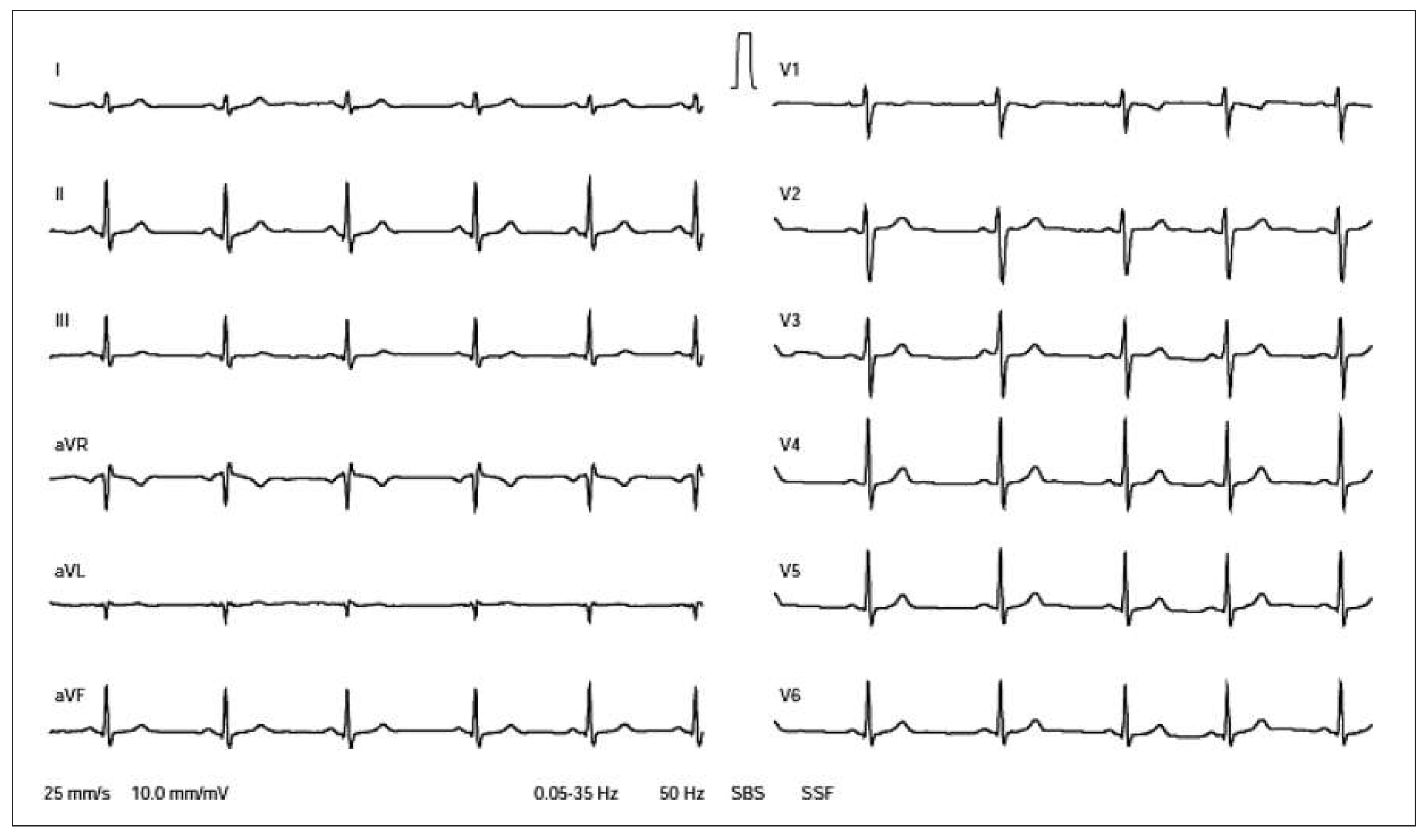 Cardiovascmed 18 00191 g001