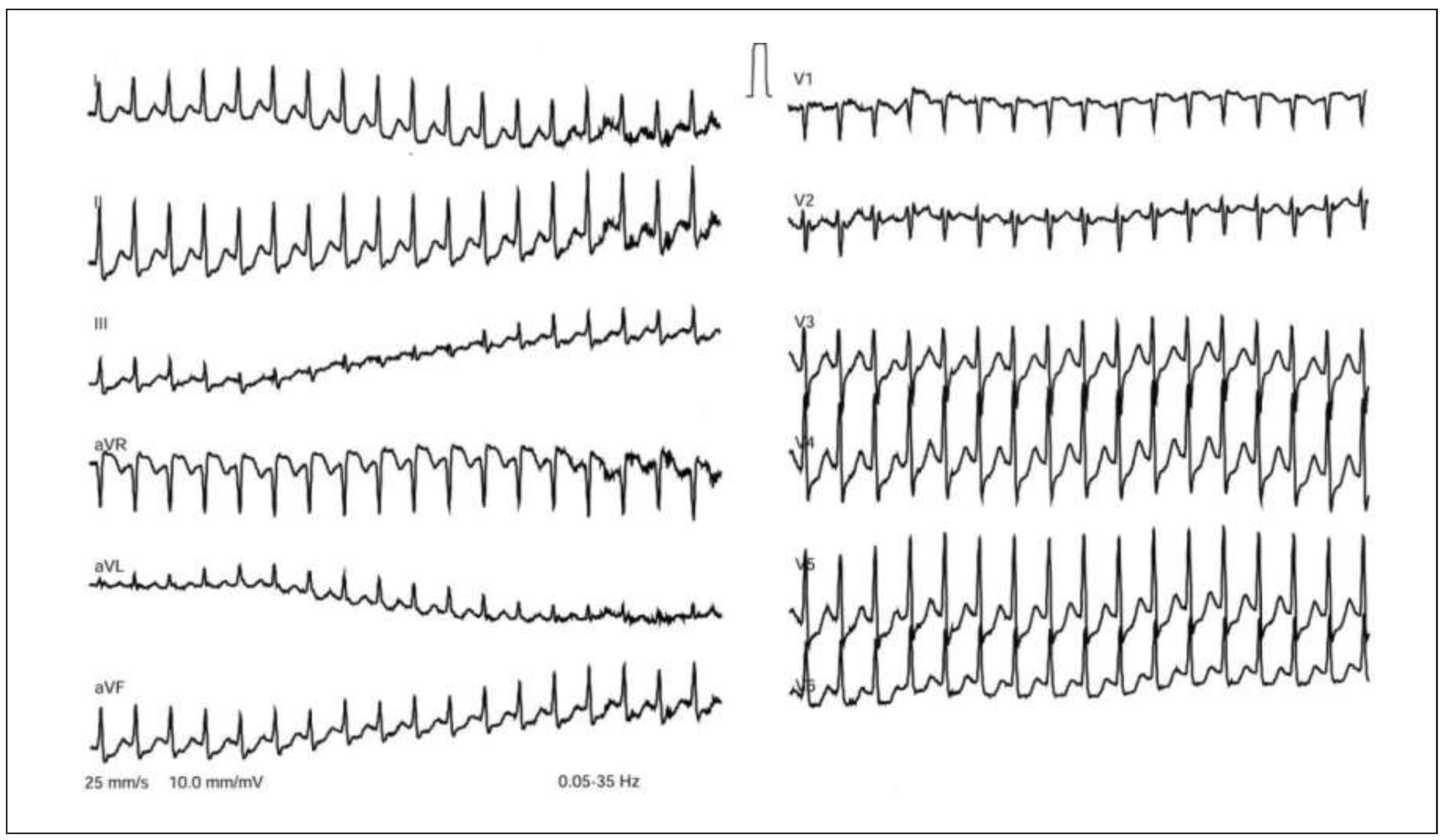 Cardiovascmed 18 00209 g002