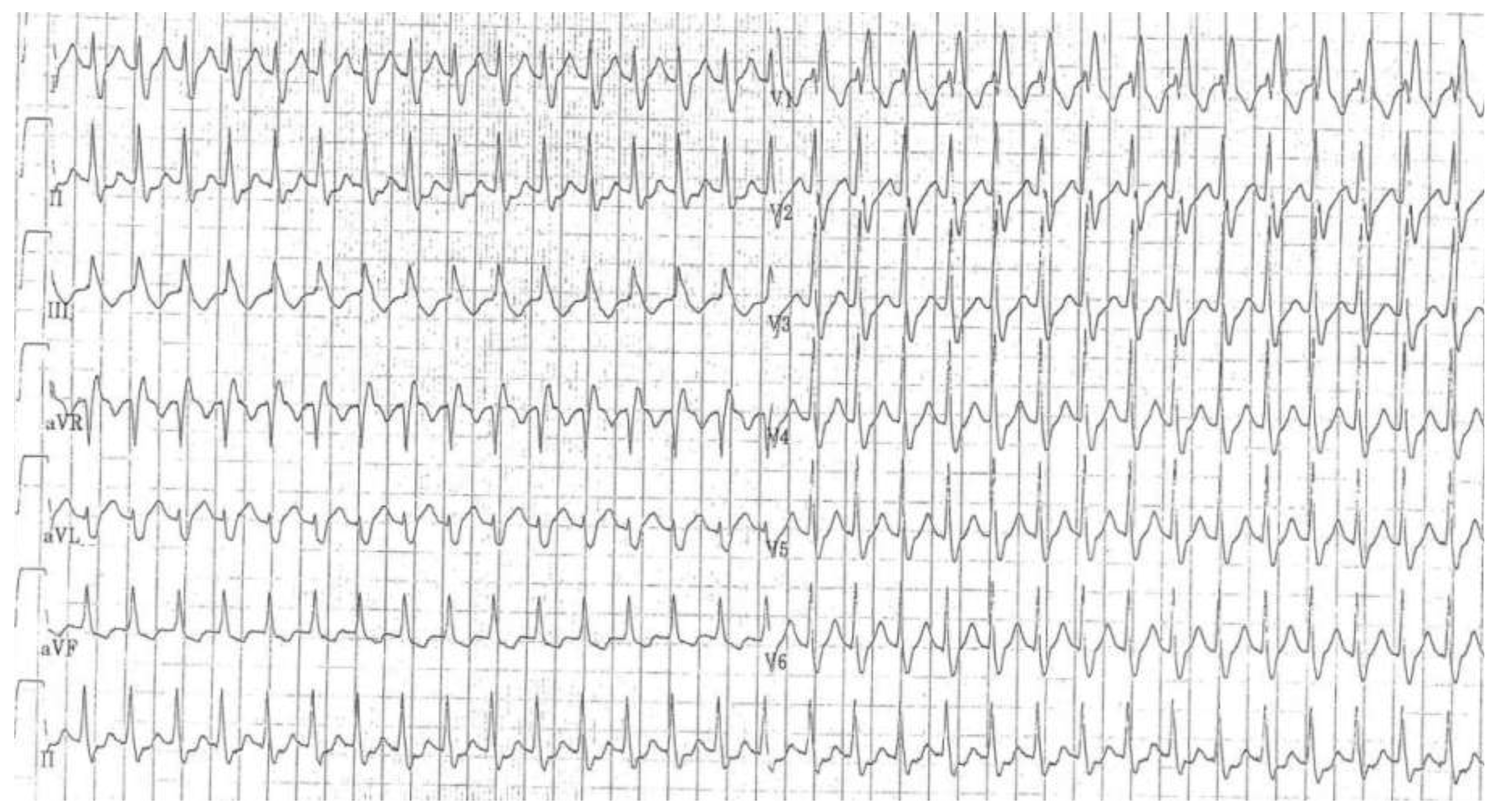 Cardiovascmed 18 00209 g004