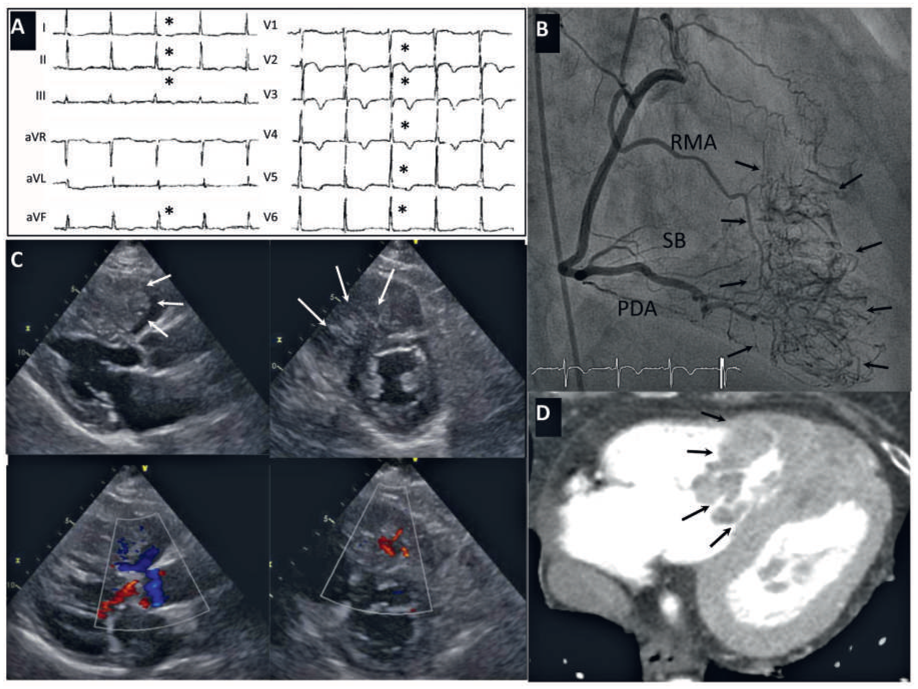 Cardiovascmed 18 00220 g001