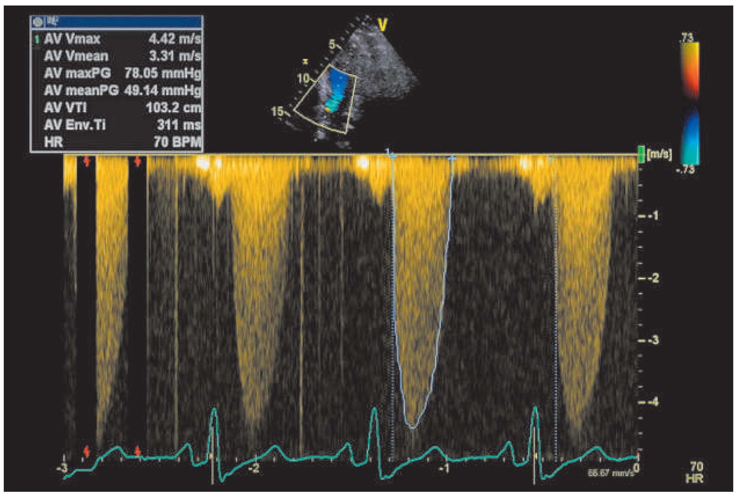 Cardiovascmed 18 00222 g002 Cardiovascmed 18 00222 g002