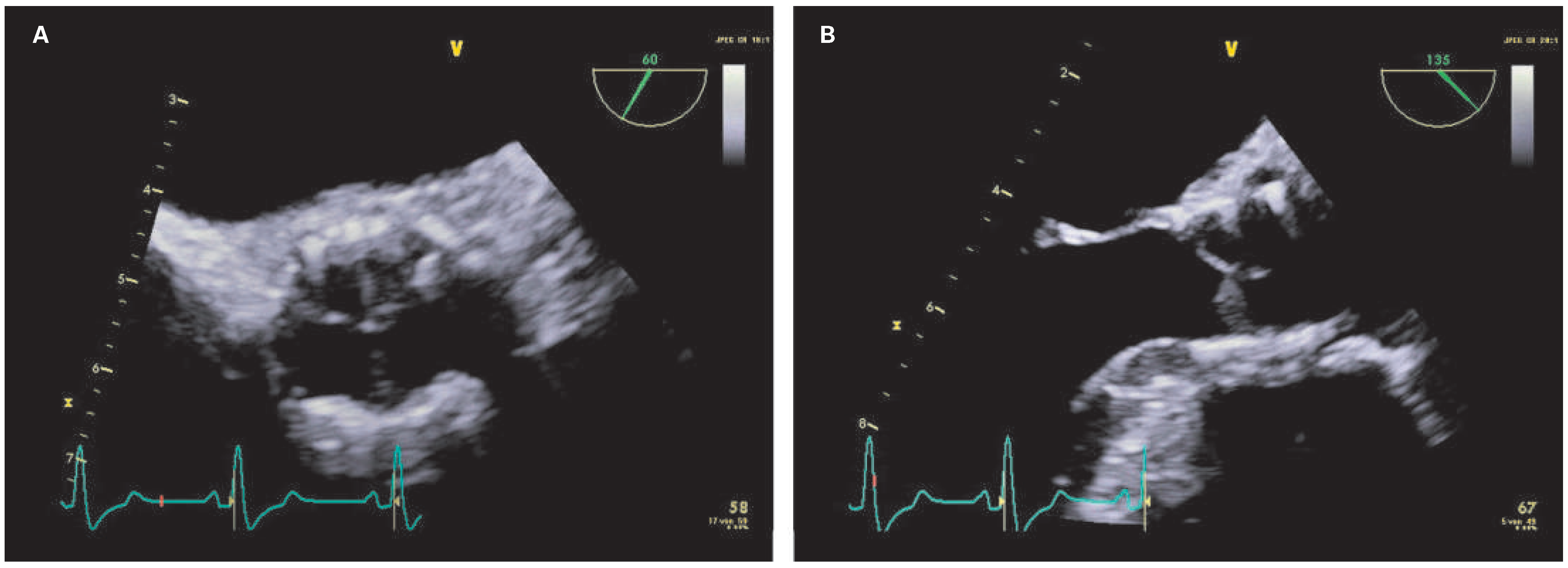 Cardiovascmed 18 00222 g003 Cardiovascmed 18 00222 g003