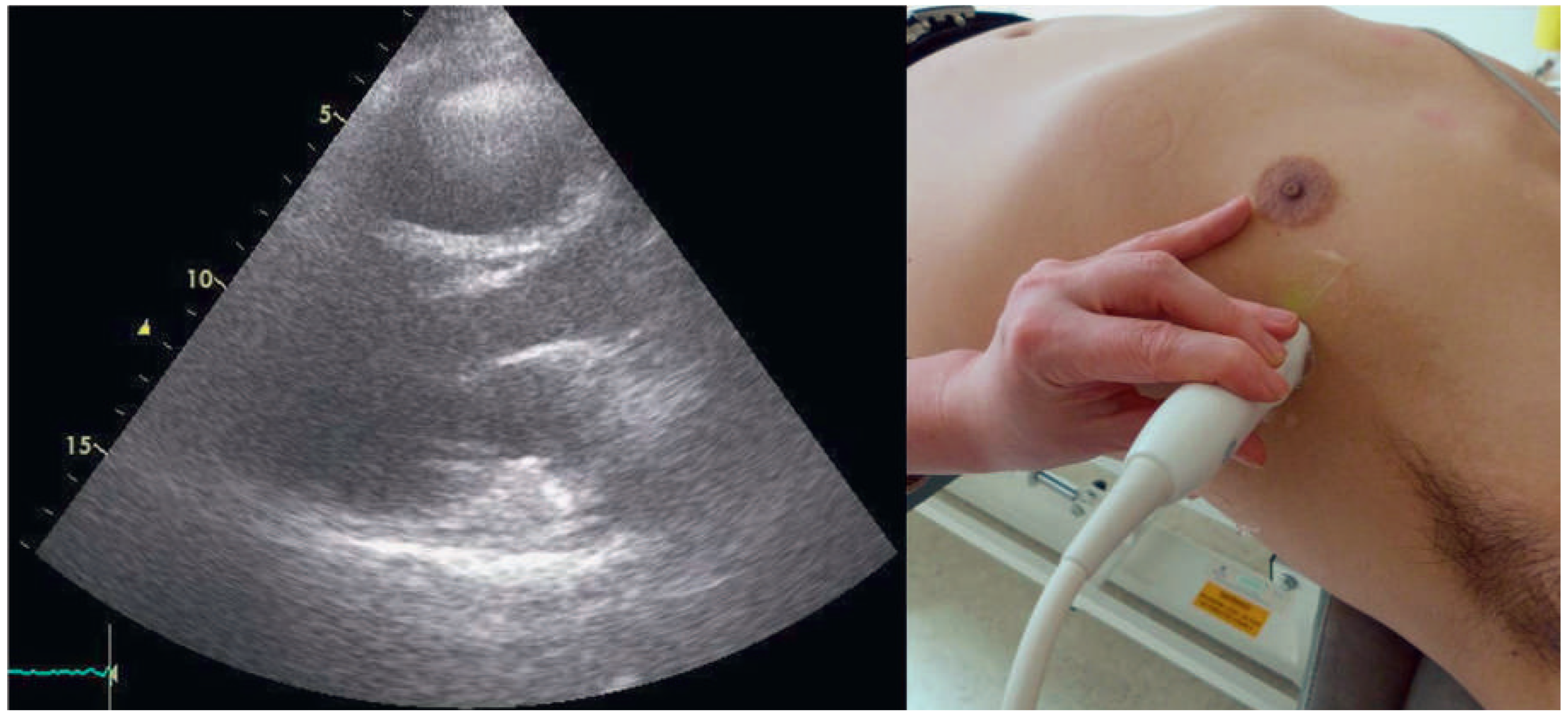 Cardiovascmed 18 00226 g002