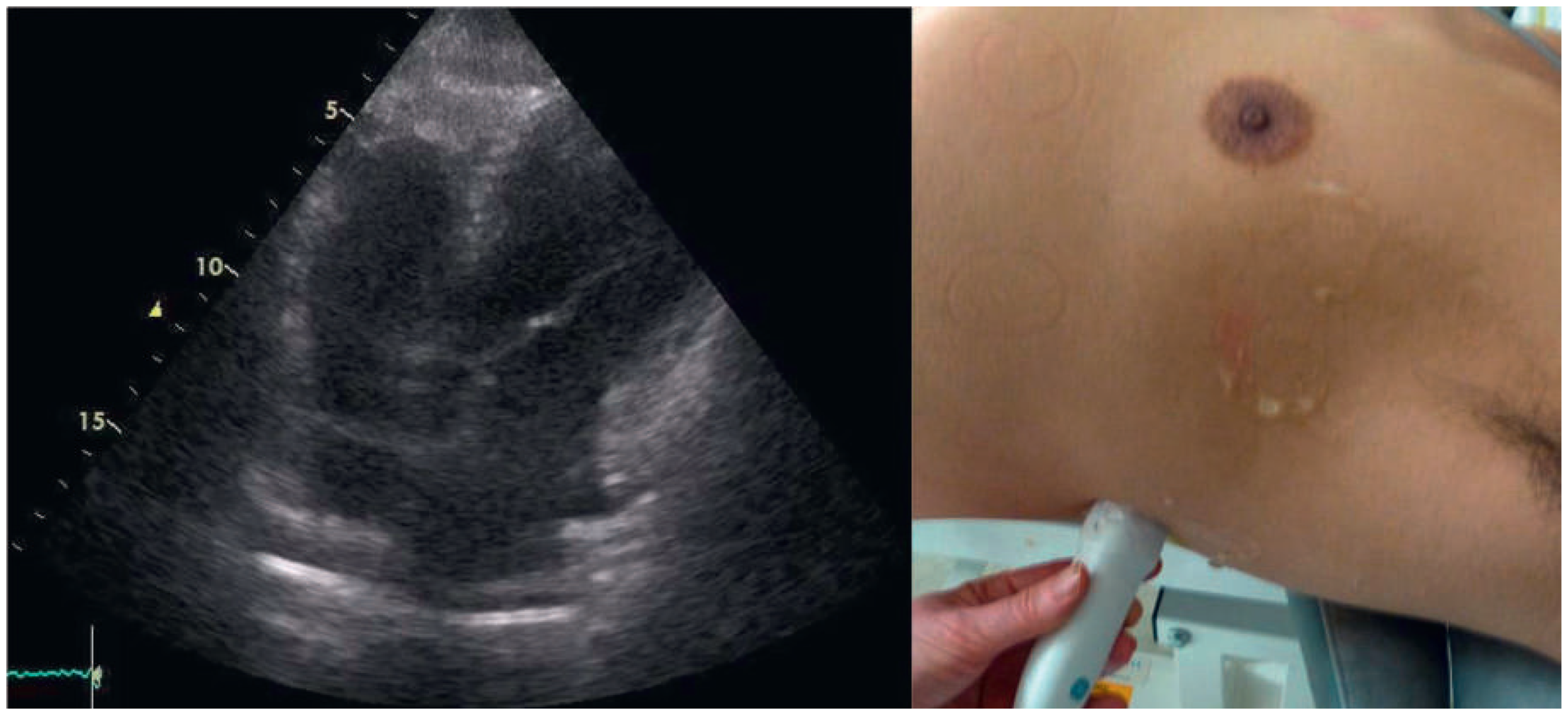 Cardiovascmed 18 00226 g003