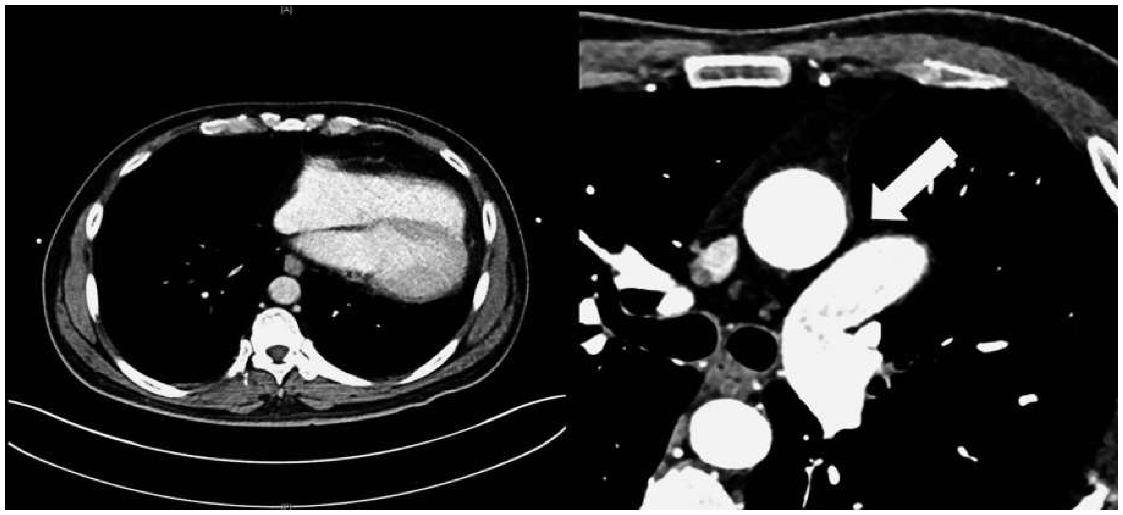 Cardiovascmed 18 00226 g004