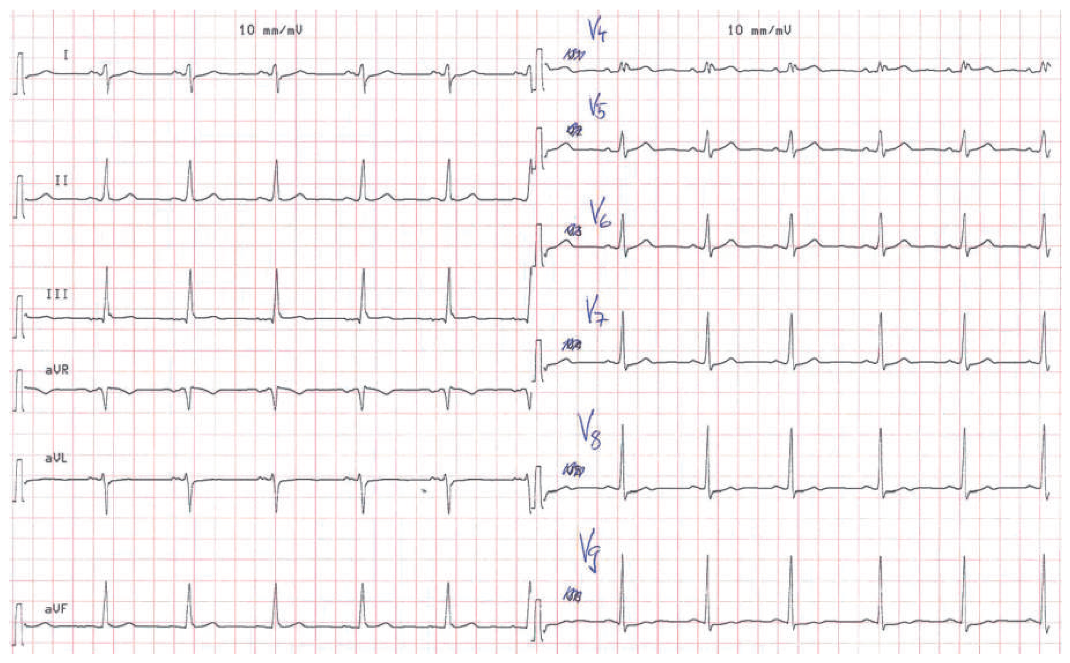 Cardiovascmed 18 00226 g005