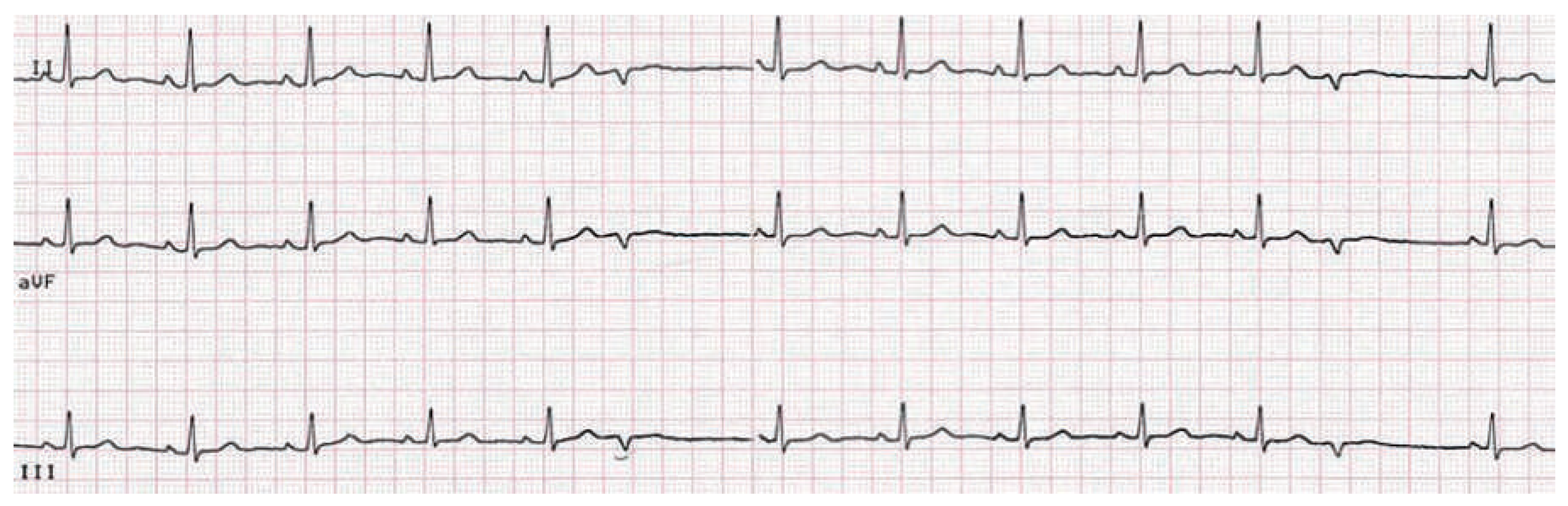 Cardiovascmed 18 00261 g001