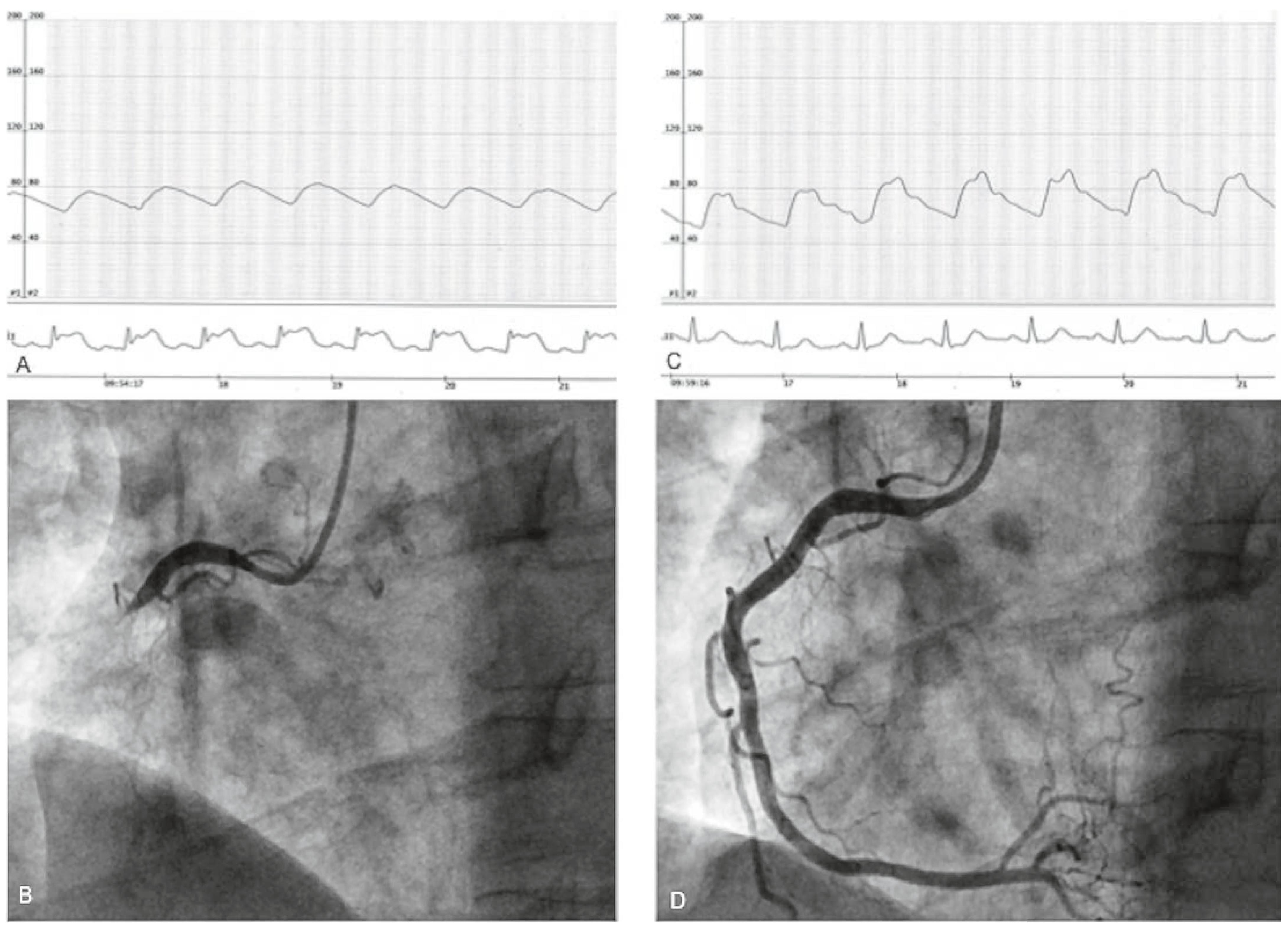 Cardiovascmed 18 00380 g001