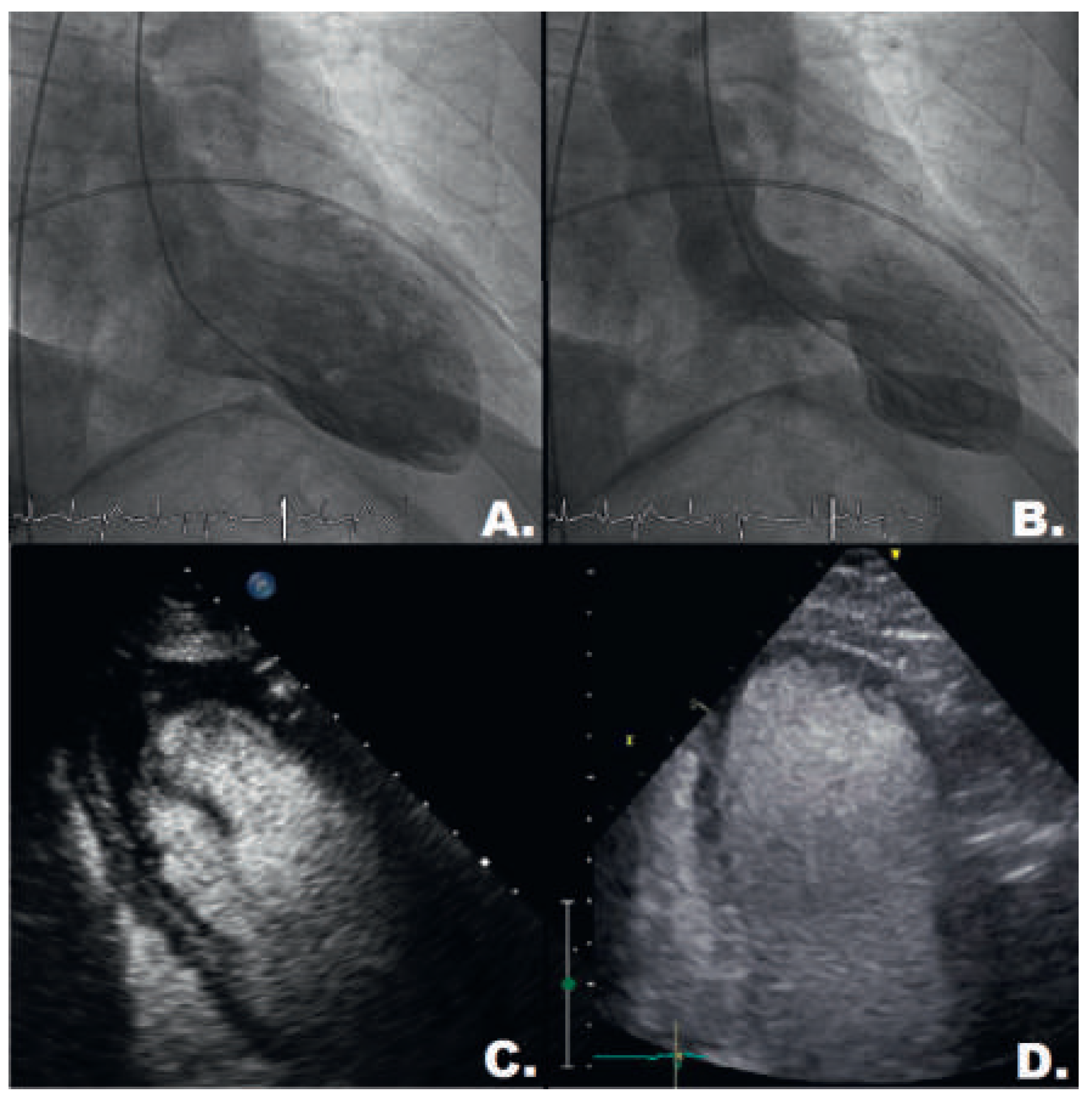 Cardiovascmed 19 00025 g002 Cardiovascmed 19 00025 g002