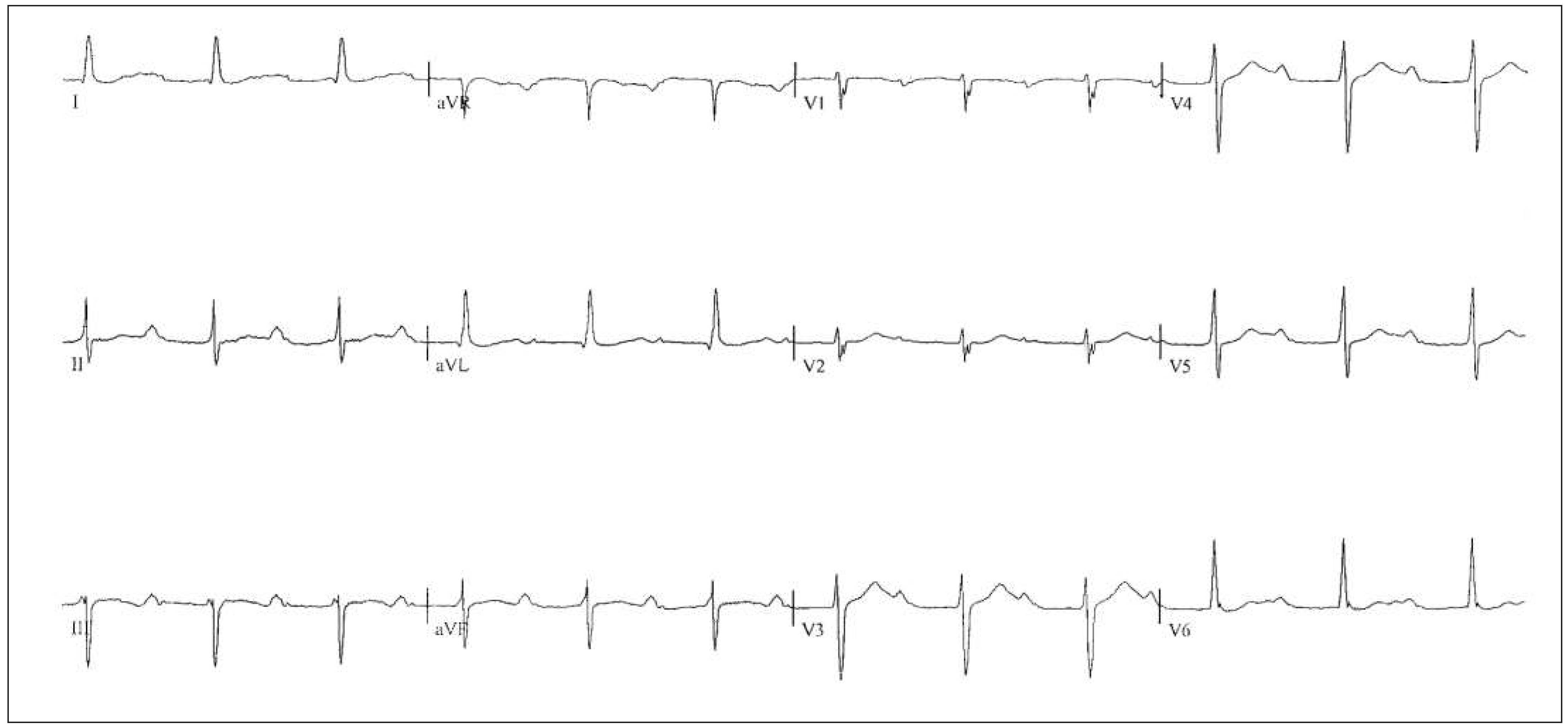 Cardiovascmed 19 00028 g001 Cardiovascmed 19 00028 g001