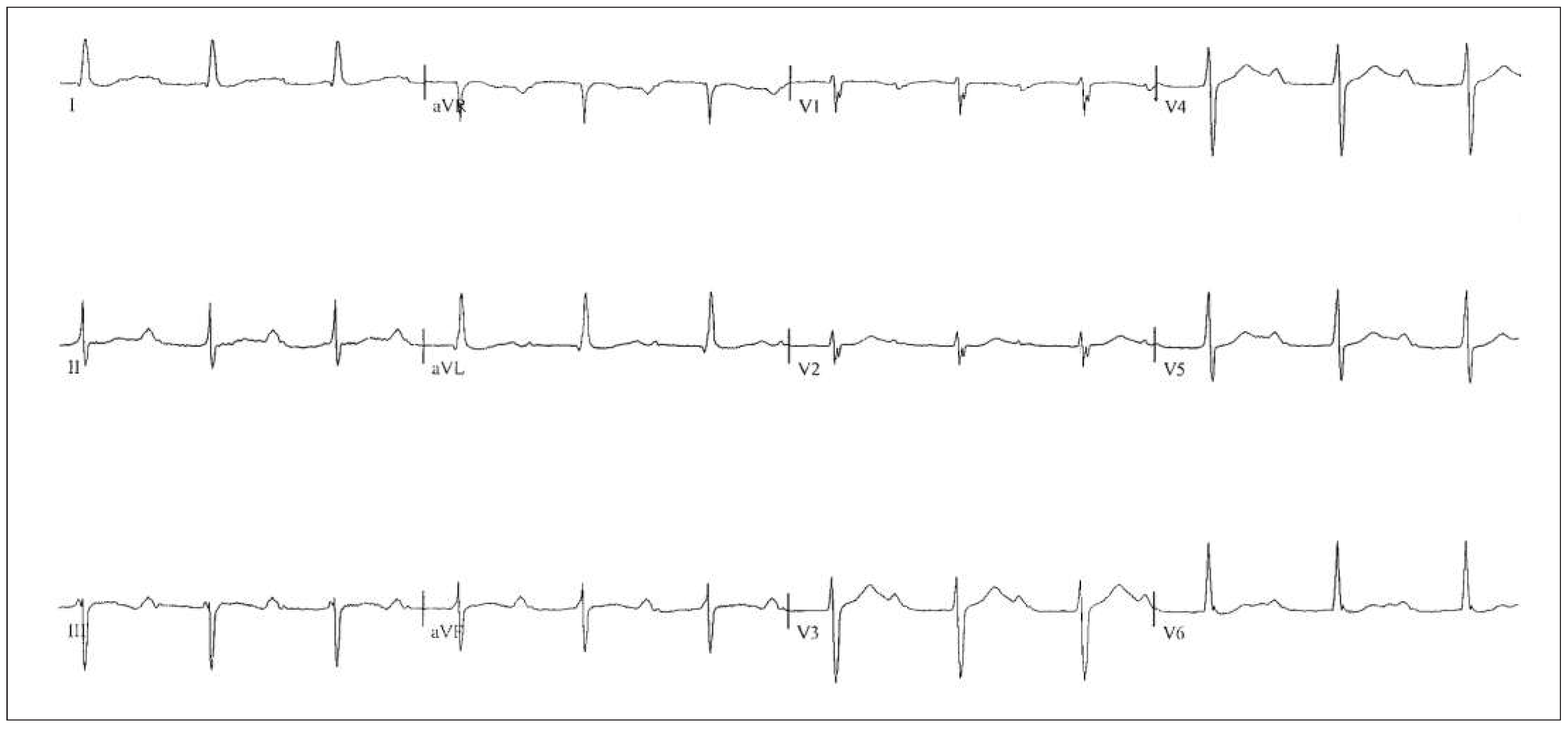 Cardiovascmed 19 00028 g002 Cardiovascmed 19 00028 g002