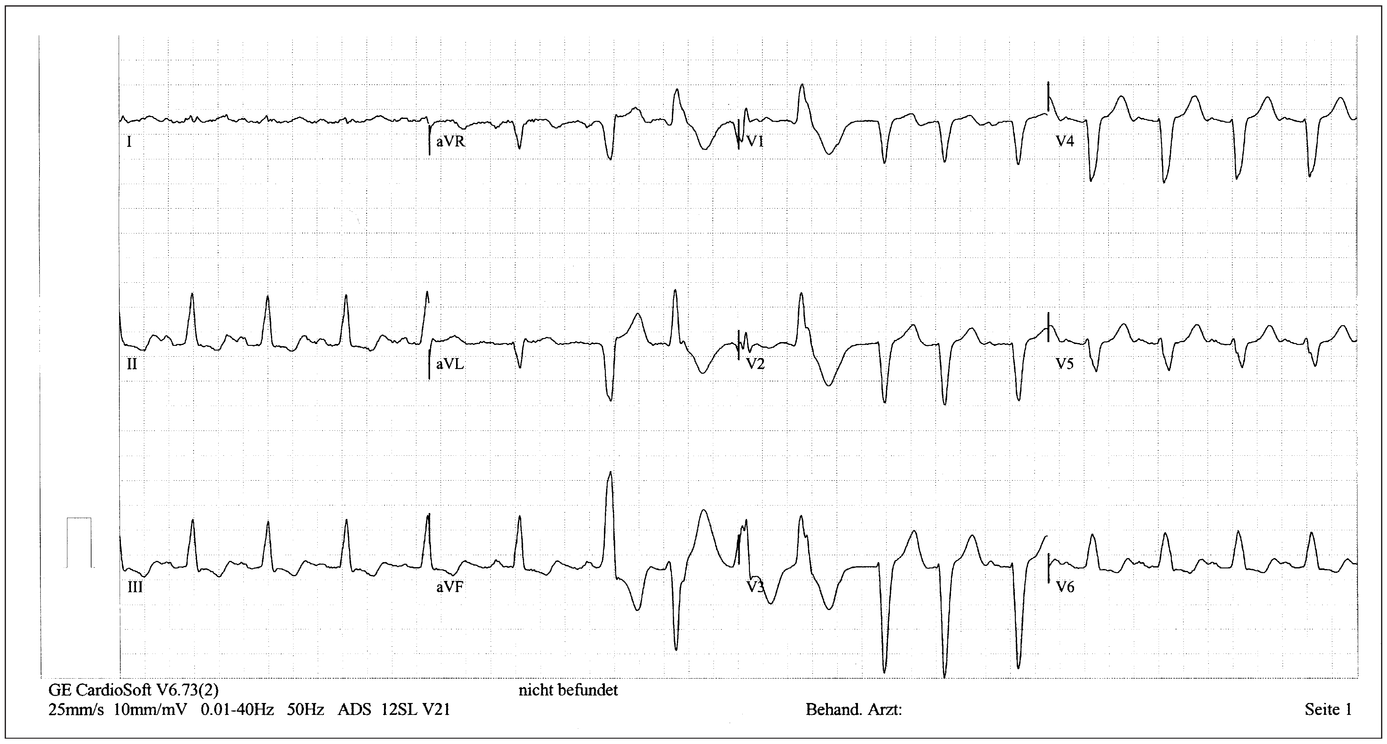 Cardiovascmed 19 00028 g003 Cardiovascmed 19 00028 g003