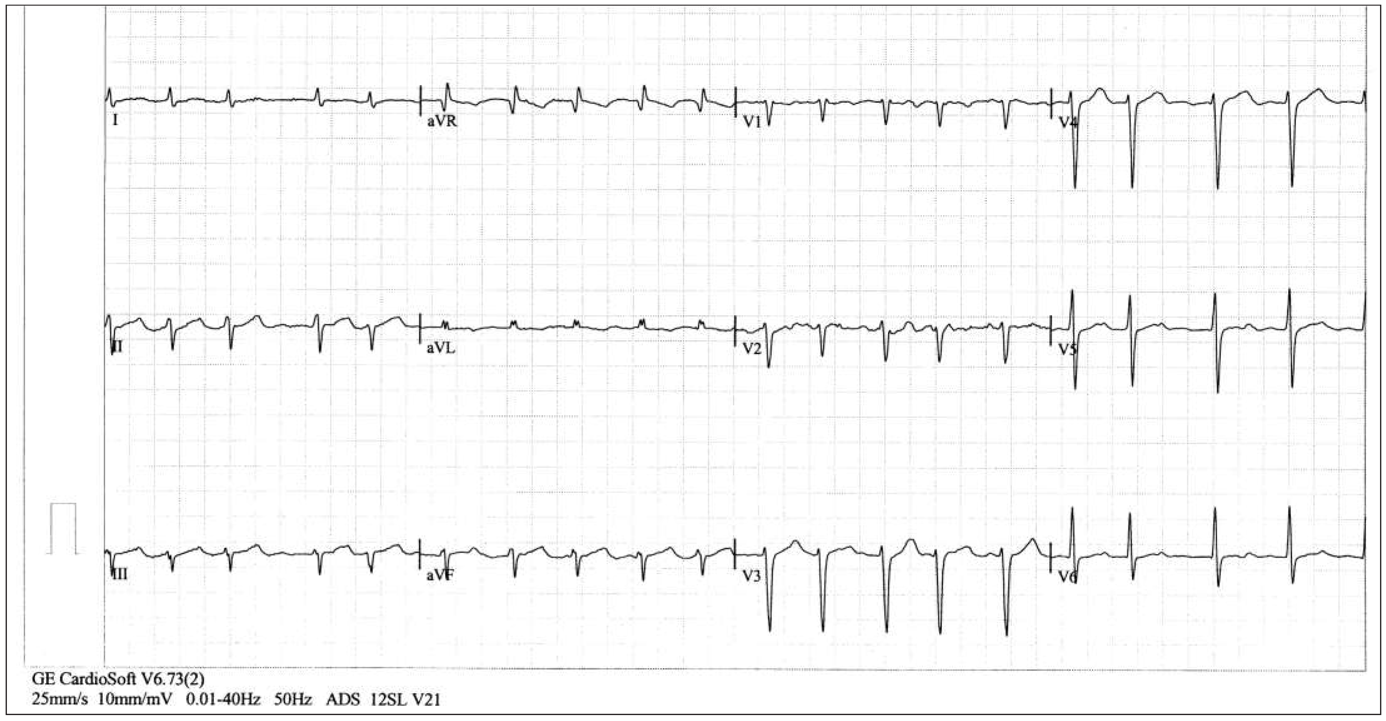 Cardiovascmed 19 00028 g004 Cardiovascmed 19 00028 g004
