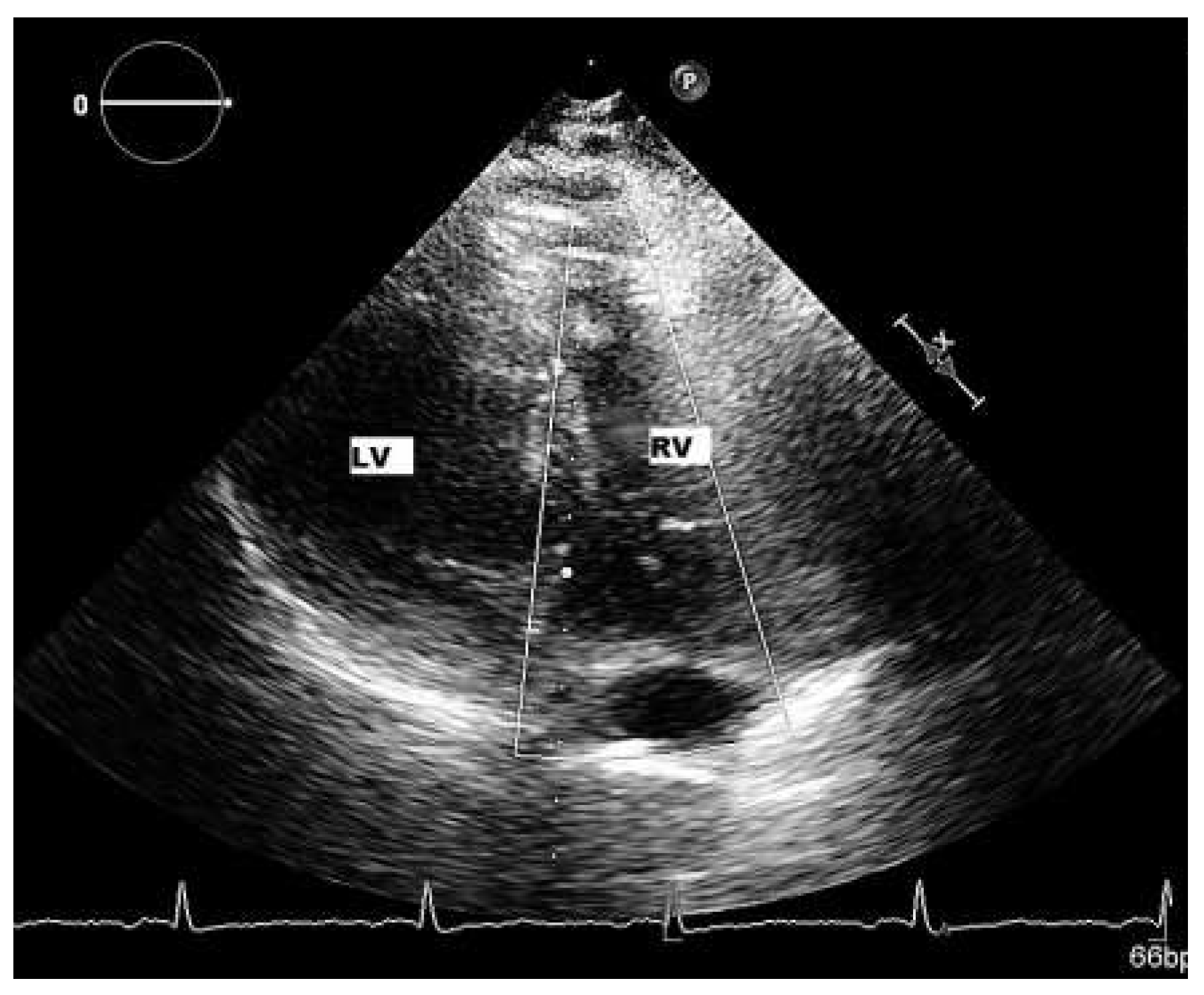 Cardiovascmed 19 00028 g006 Cardiovascmed 19 00028 g006