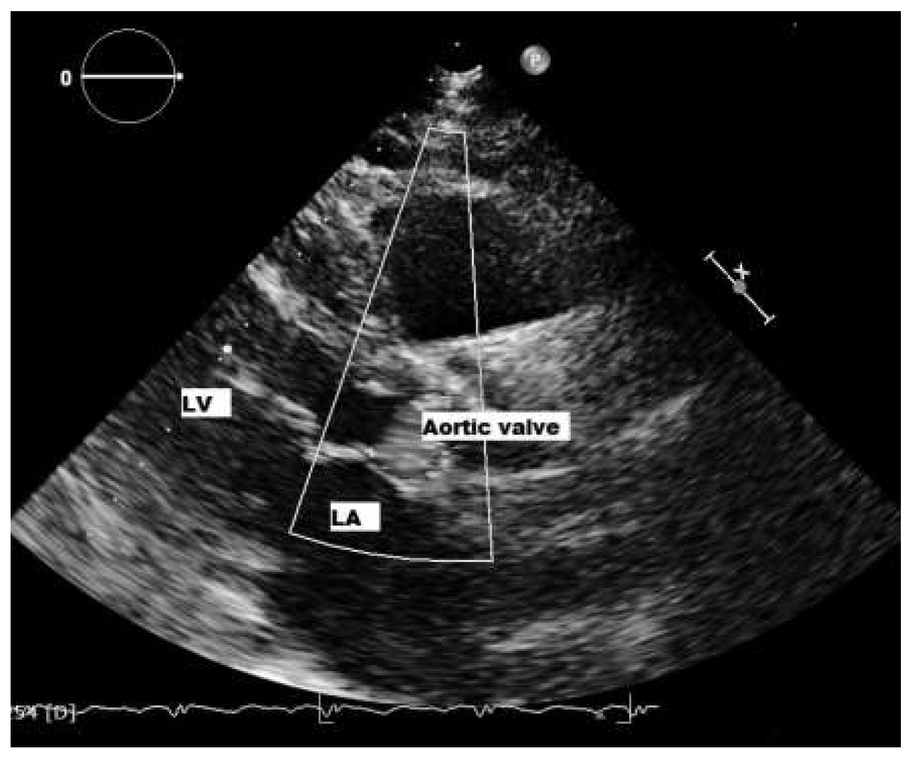 Cardiovascmed 19 00028 g007 Cardiovascmed 19 00028 g007