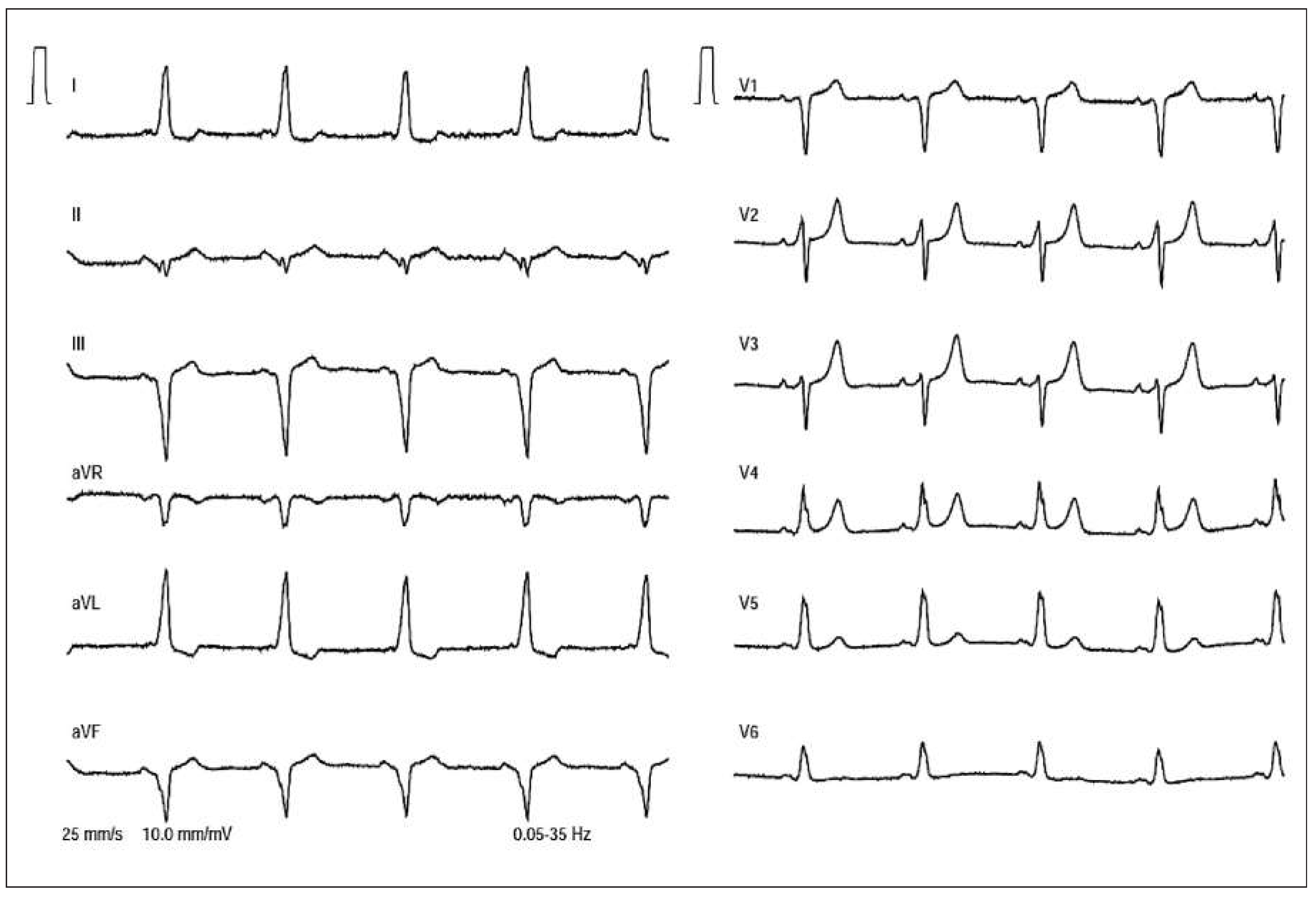 Cardiovascmed 19 00034 g001 Cardiovascmed 19 00034 g001