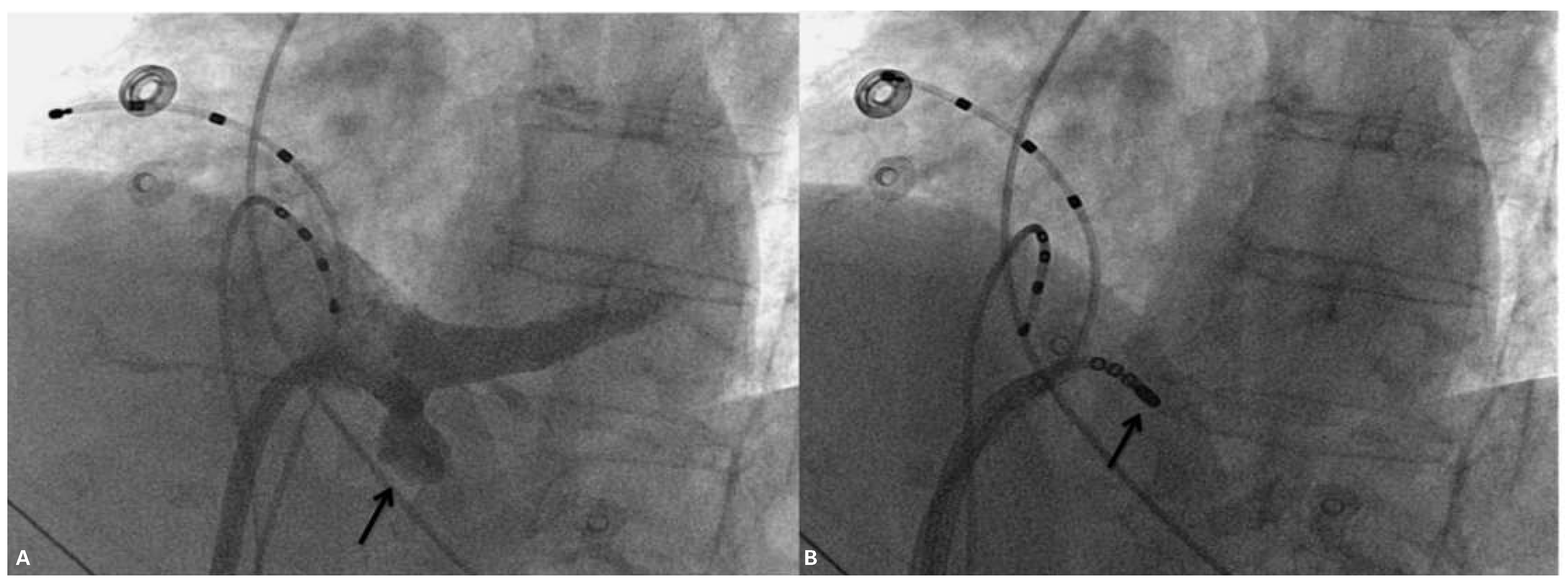 Cardiovascmed 19 00034 g002 Cardiovascmed 19 00034 g002