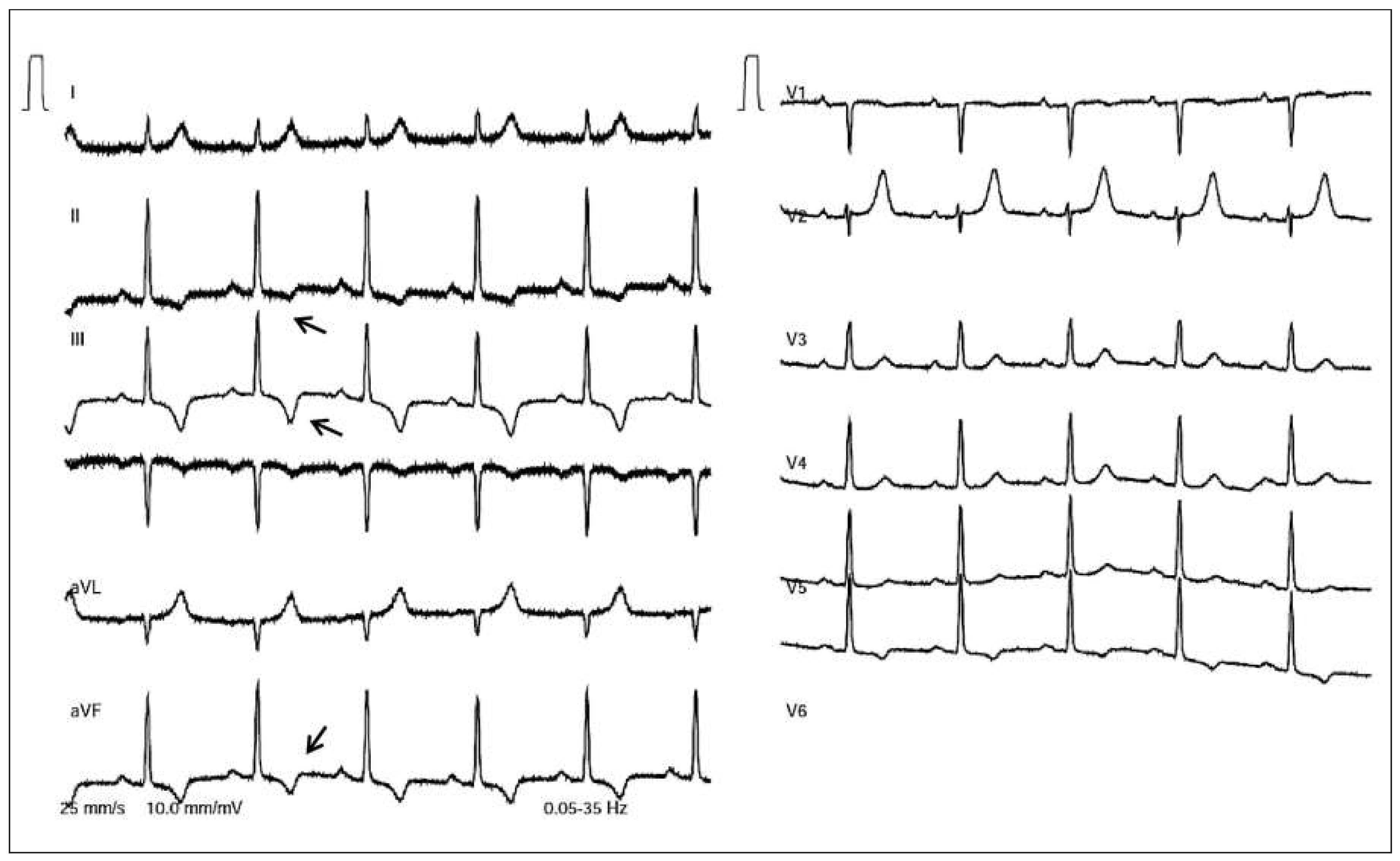 Cardiovascmed 19 00034 g003 Cardiovascmed 19 00034 g003