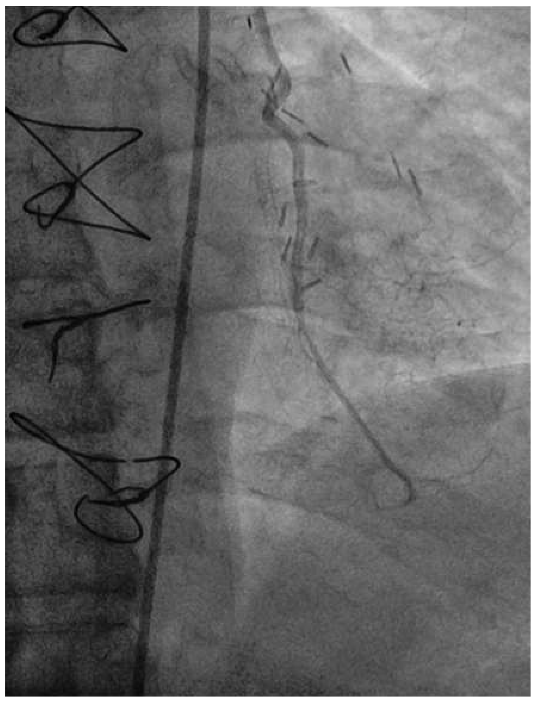 Cardiovascmed 19 00055 g002