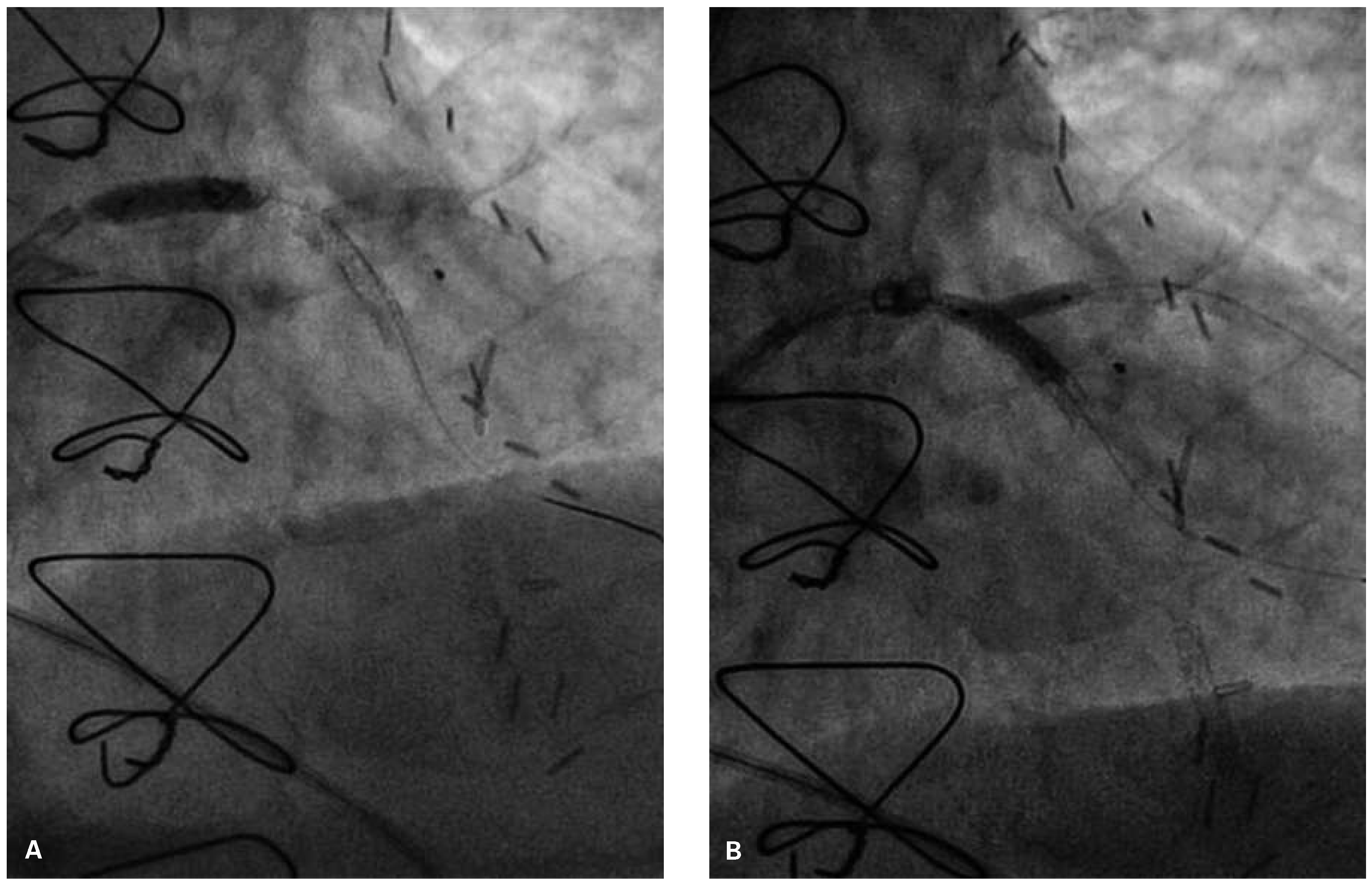 Cardiovascmed 19 00055 g005