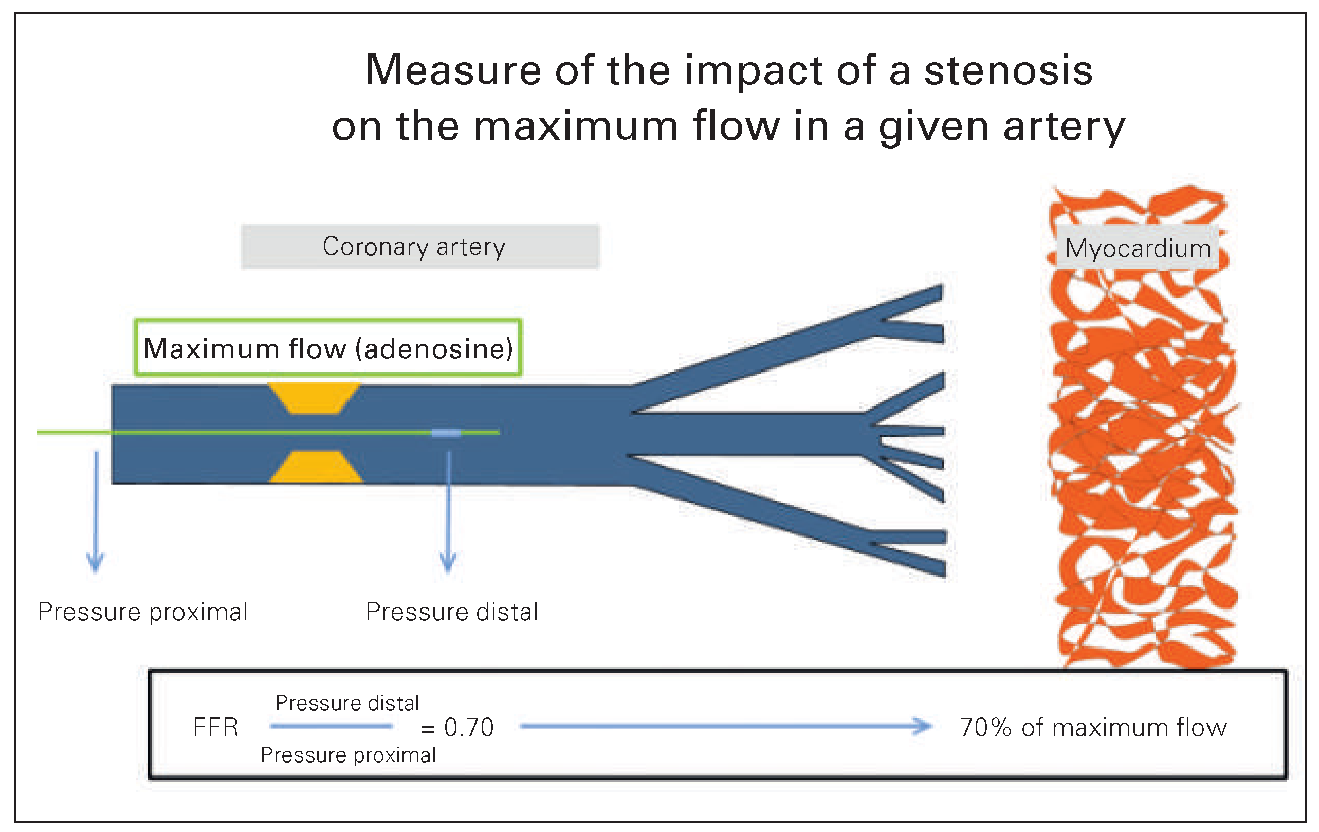 Cardiovascmed 19 00067 g002 Cardiovascmed 19 00067 g002