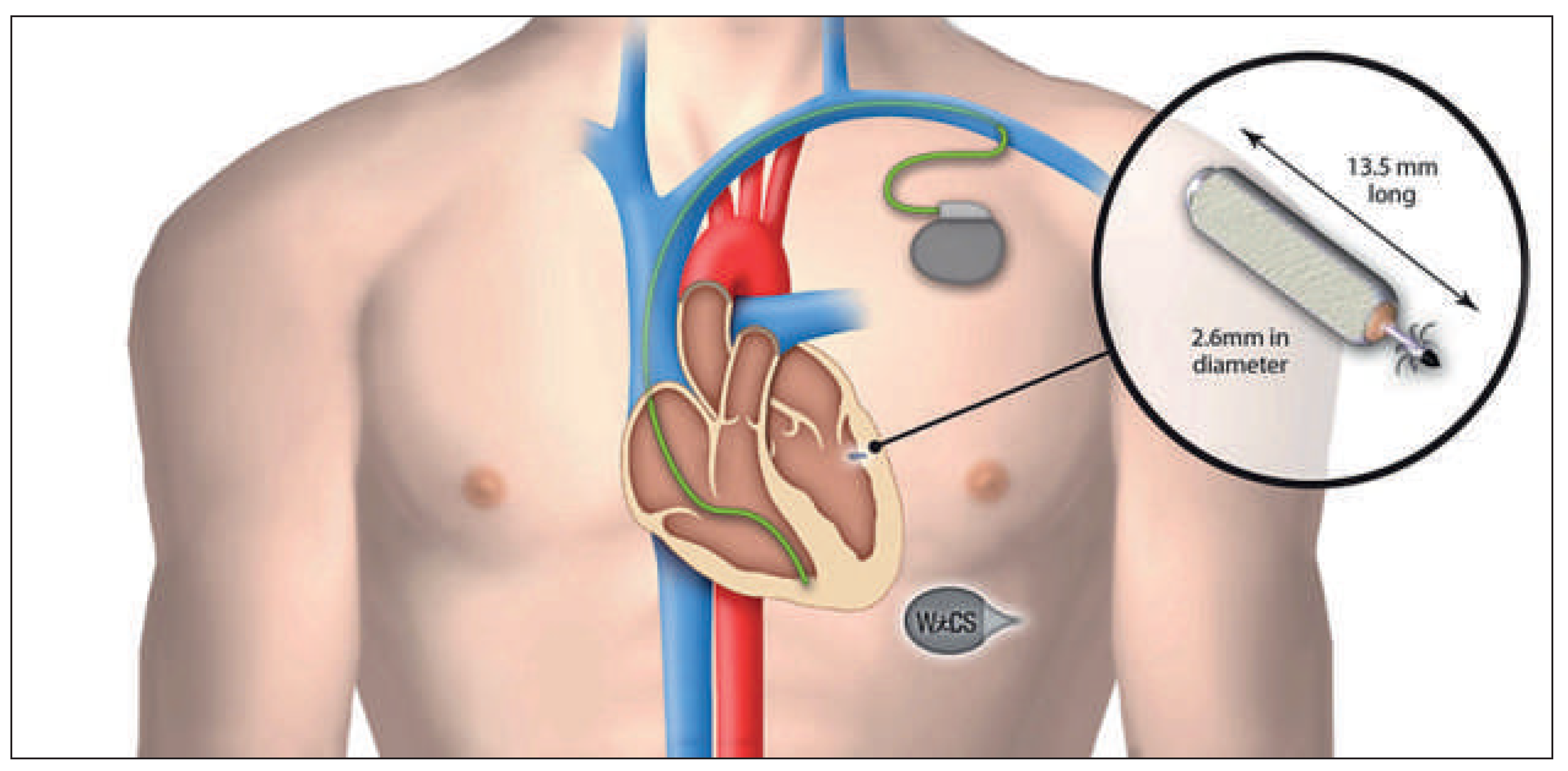 Cardiovascmed 19 00083 g002 Cardiovascmed 19 00083 g002