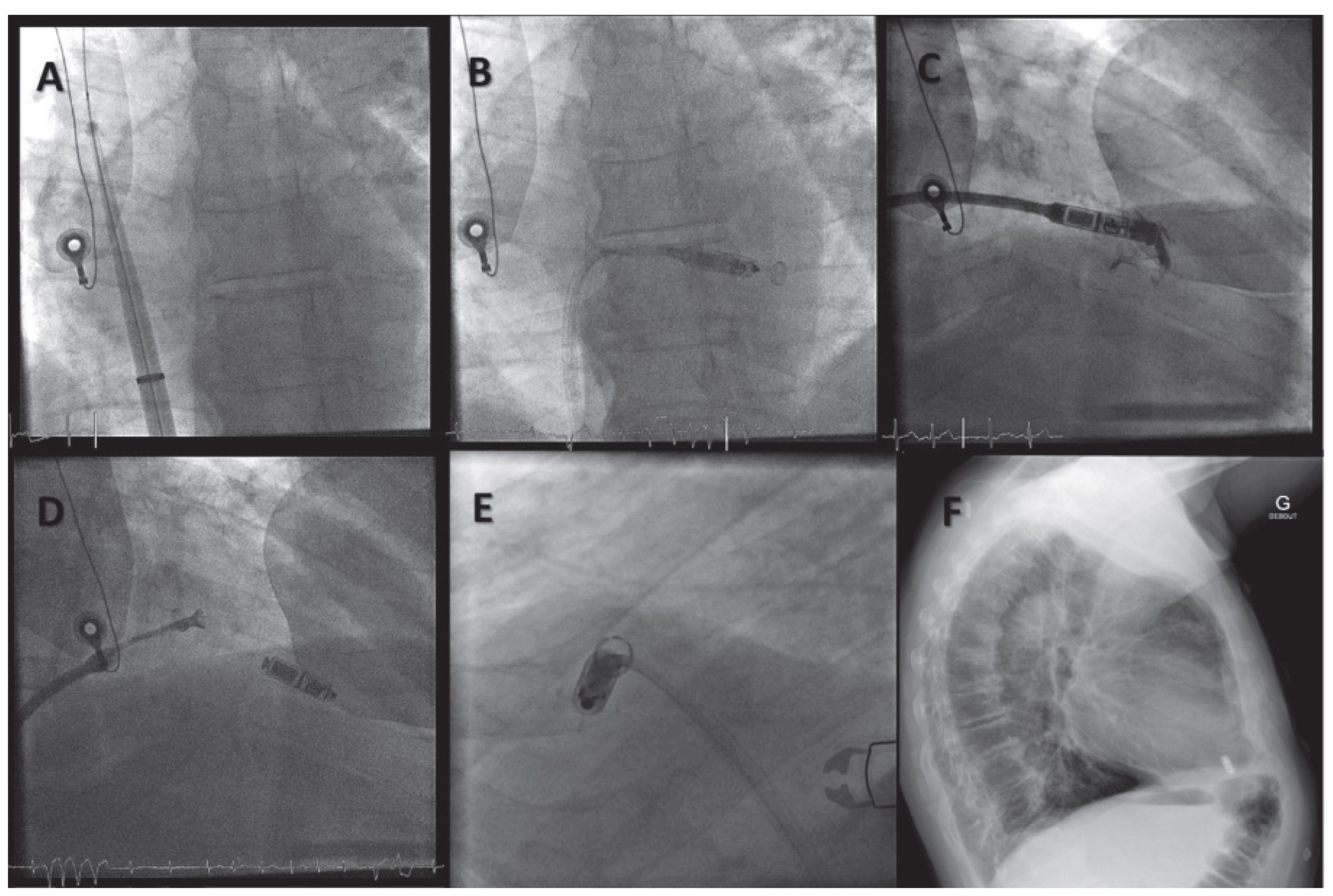 Cardiovascmed 19 00083 g003 Cardiovascmed 19 00083 g003
