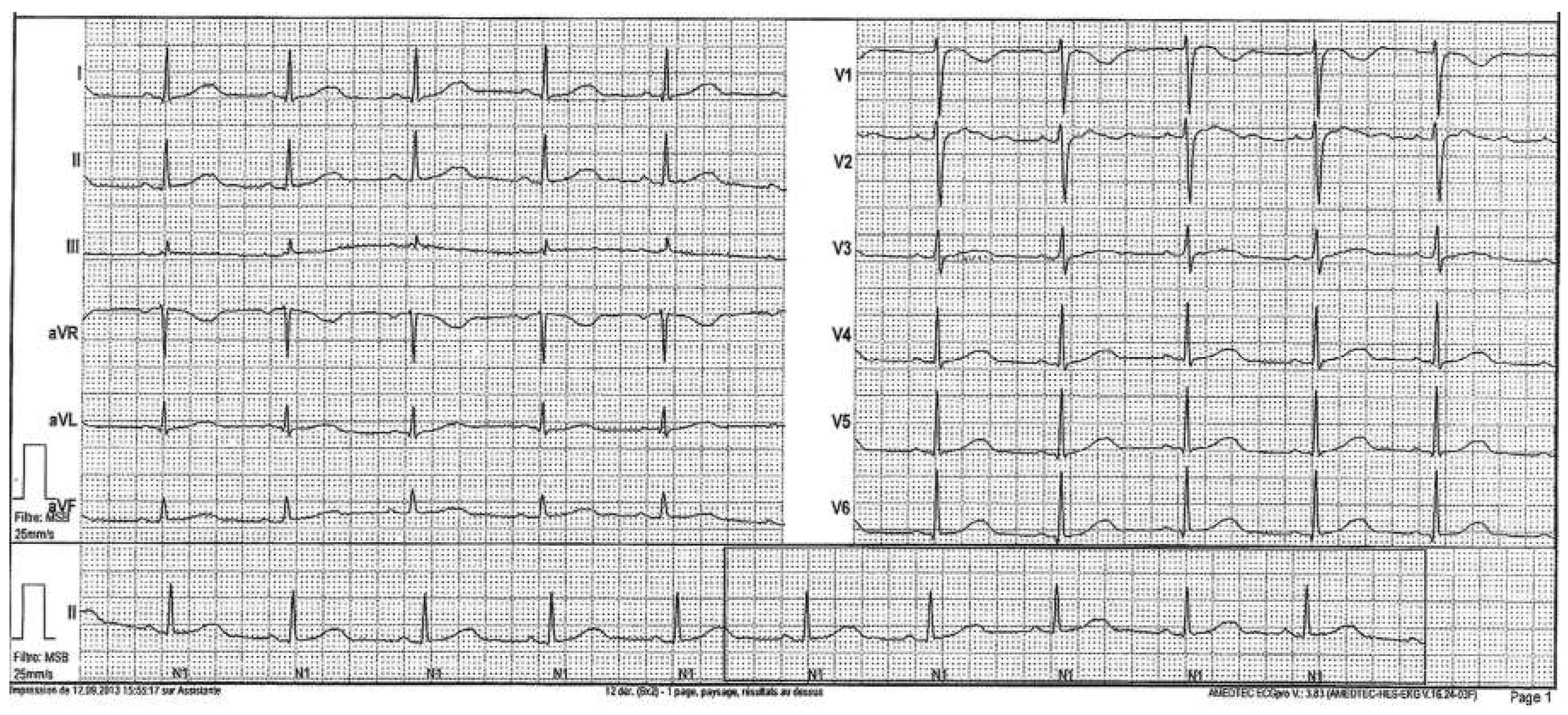 Cardiovascmed 19 00090 g002 Cardiovascmed 19 00090 g002