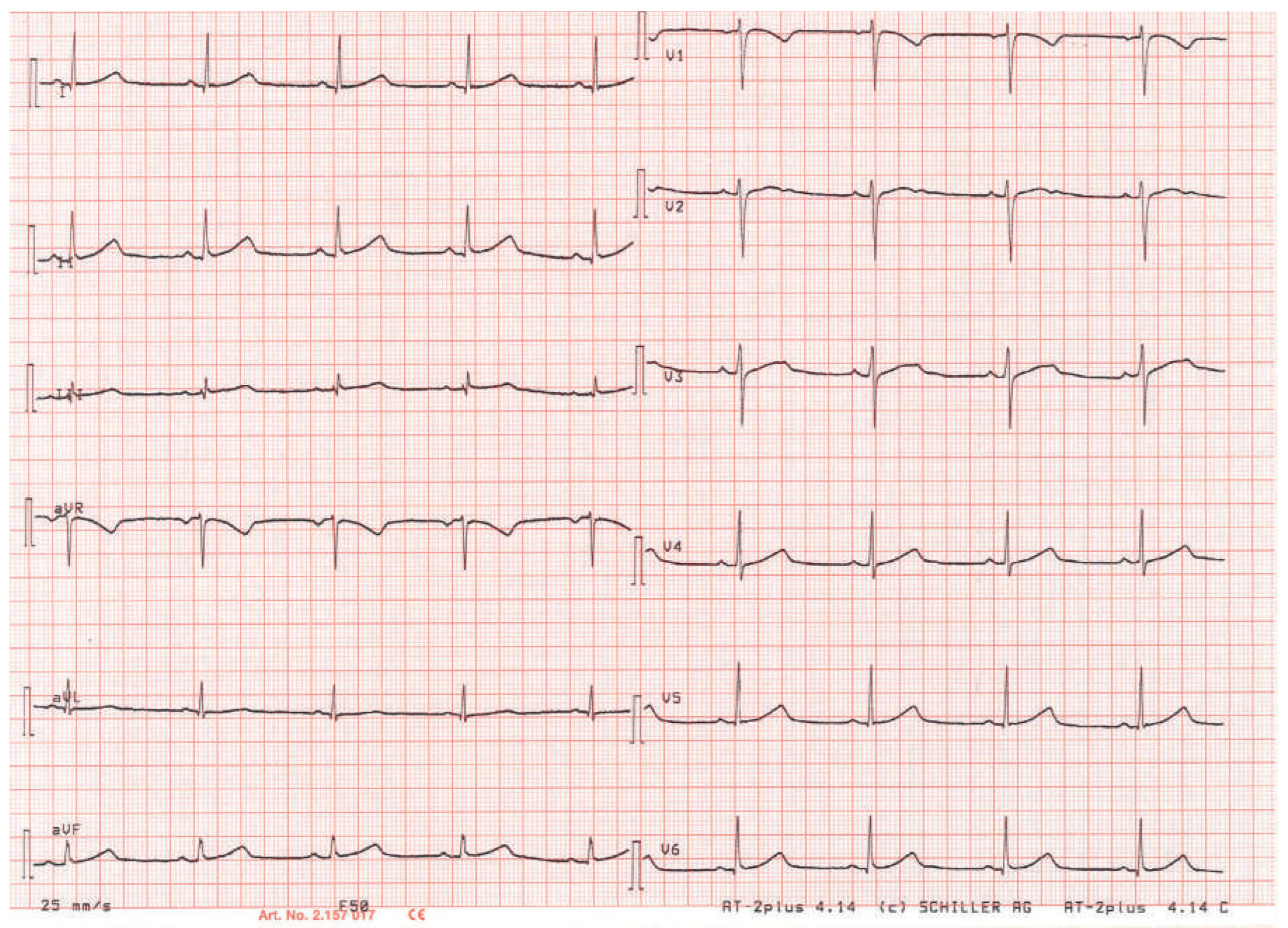Cardiovascmed 19 00090 g005 Cardiovascmed 19 00090 g005