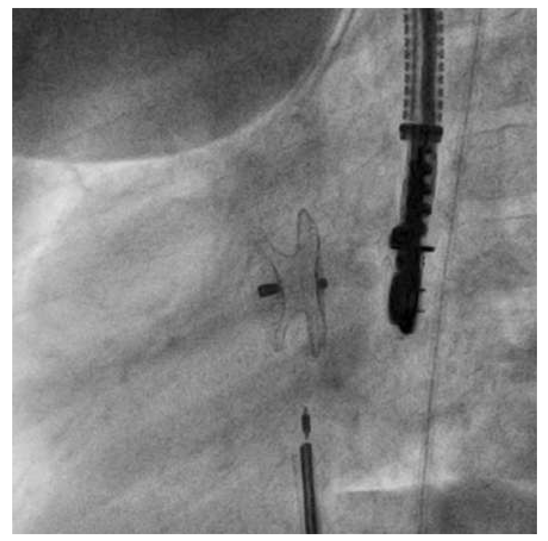 Cardiovascmed 19 00095 g002 Cardiovascmed 19 00095 g002