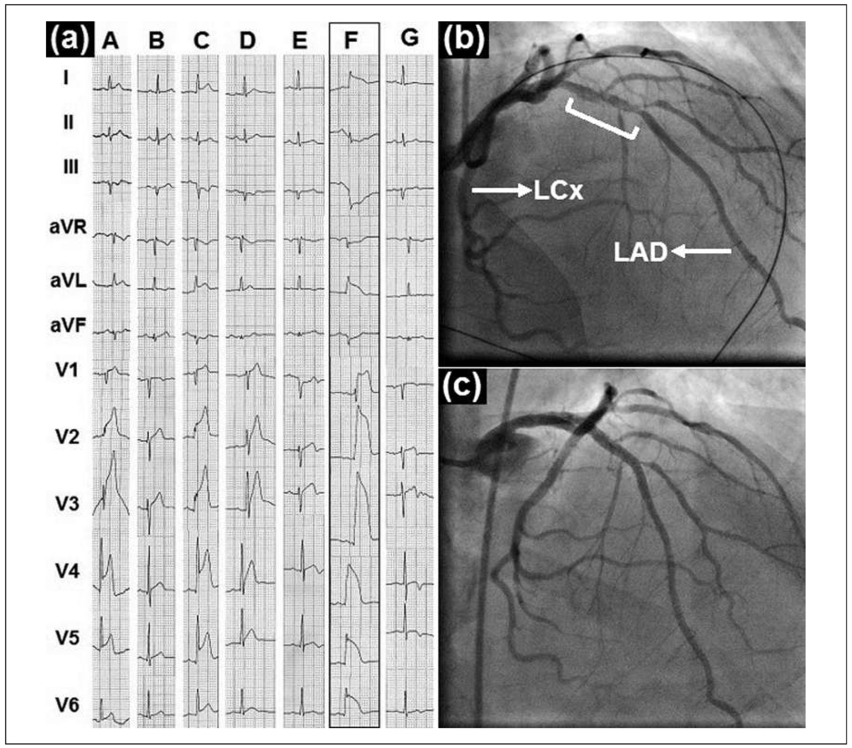 Cardiovascmed 19 00097 g001 Cardiovascmed 19 00097 g001