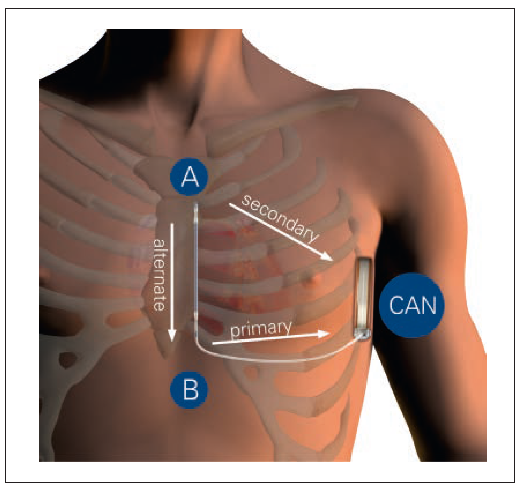Cardiovascmed 19 00121 g002 Cardiovascmed 19 00121 g002