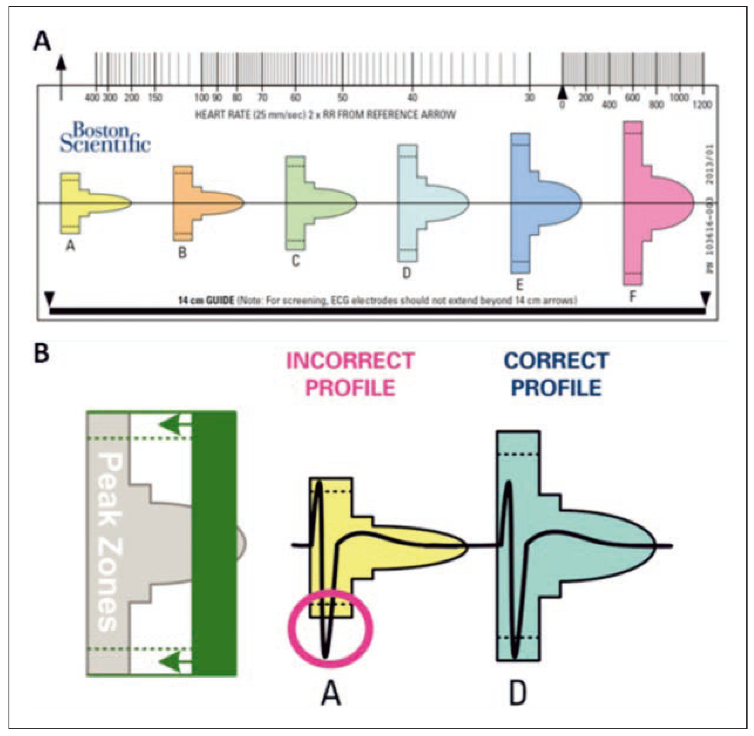 Cardiovascmed 19 00121 g004 Cardiovascmed 19 00121 g004