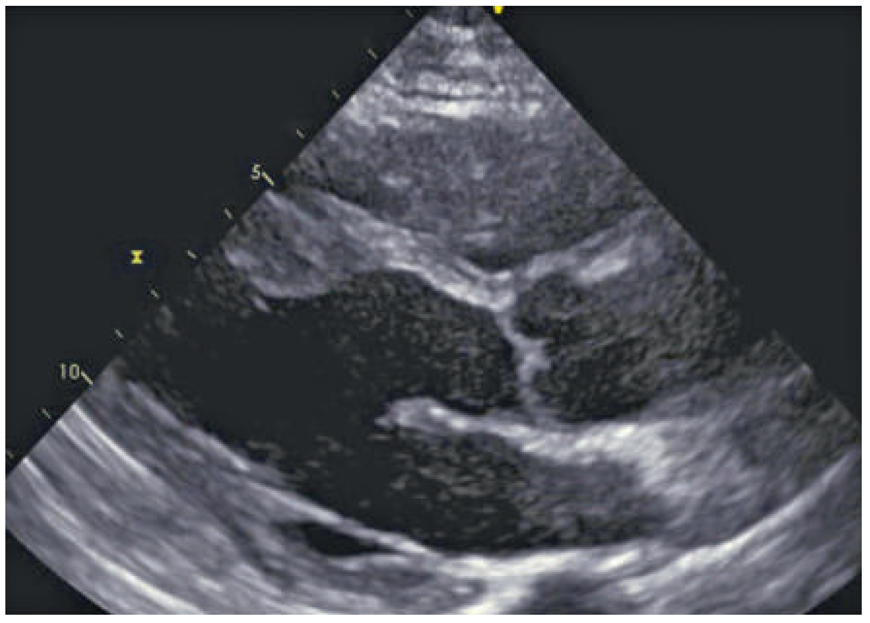 Cardiovascmed 19 00128 g001