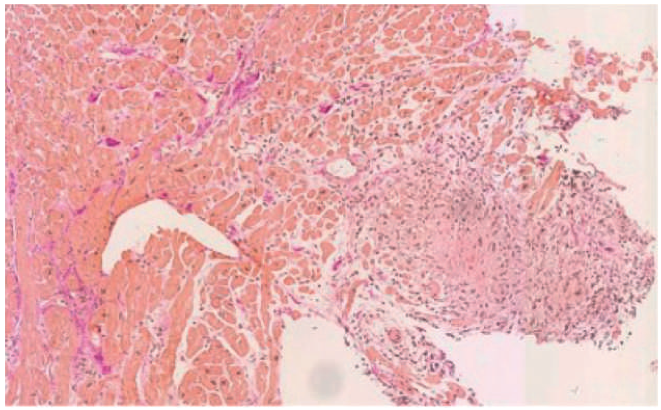 Cardiovascmed 19 00128 g002