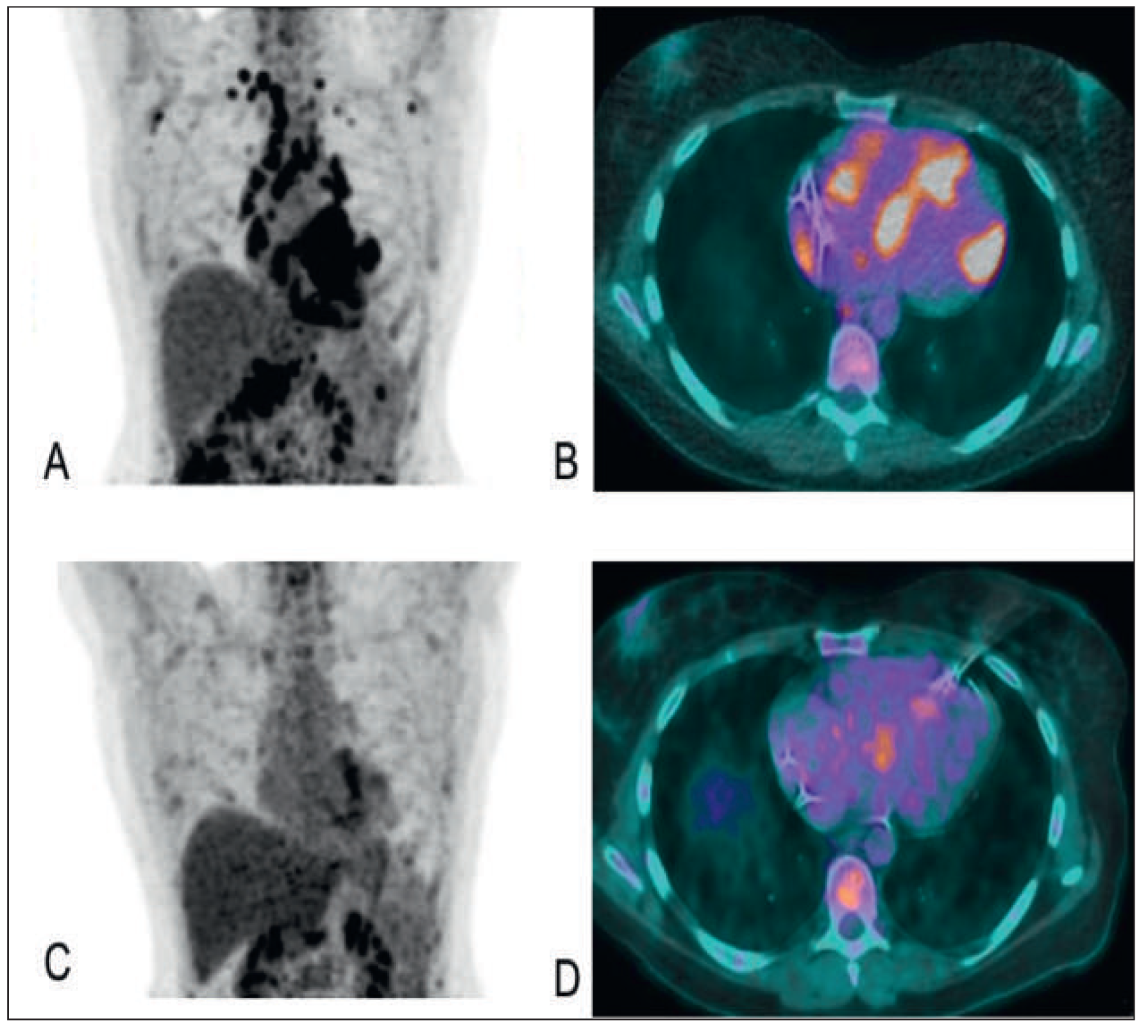 Cardiovascmed 19 00128 g003