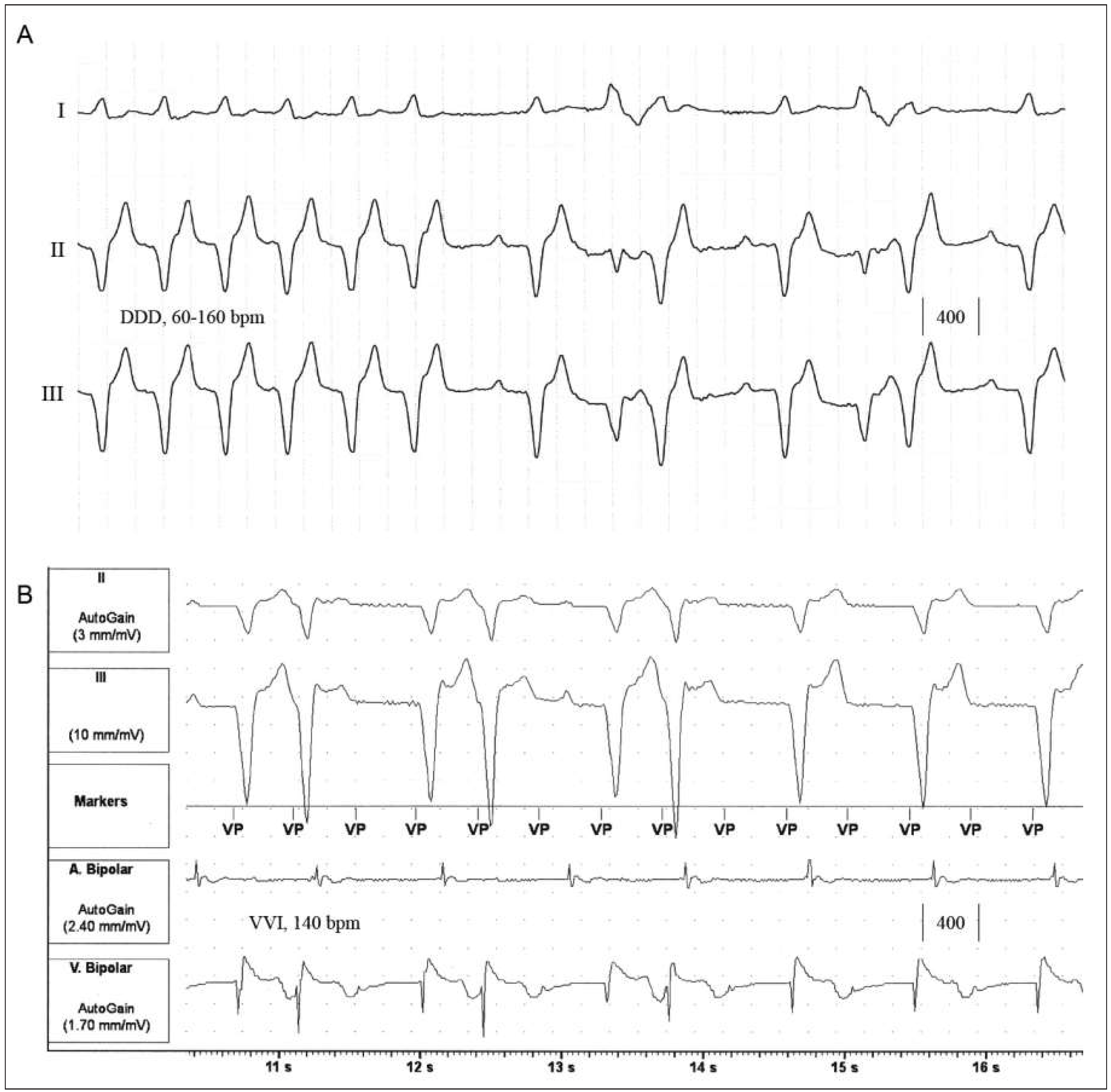 Cardiovascmed 19 00134 g001 Cardiovascmed 19 00134 g001
