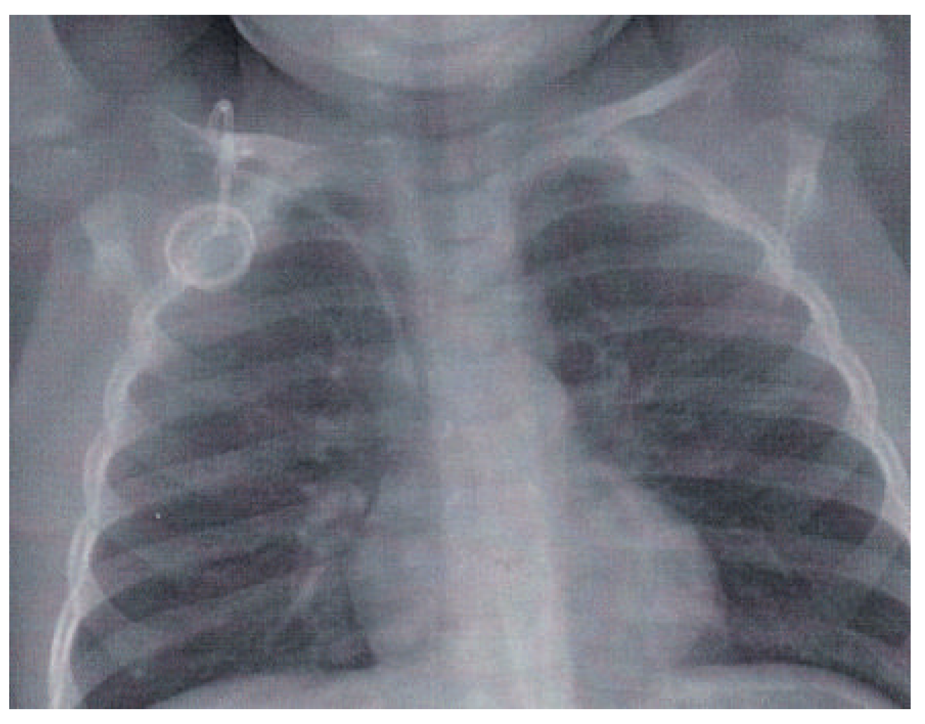 Cardiovascmed 19 00136 g001