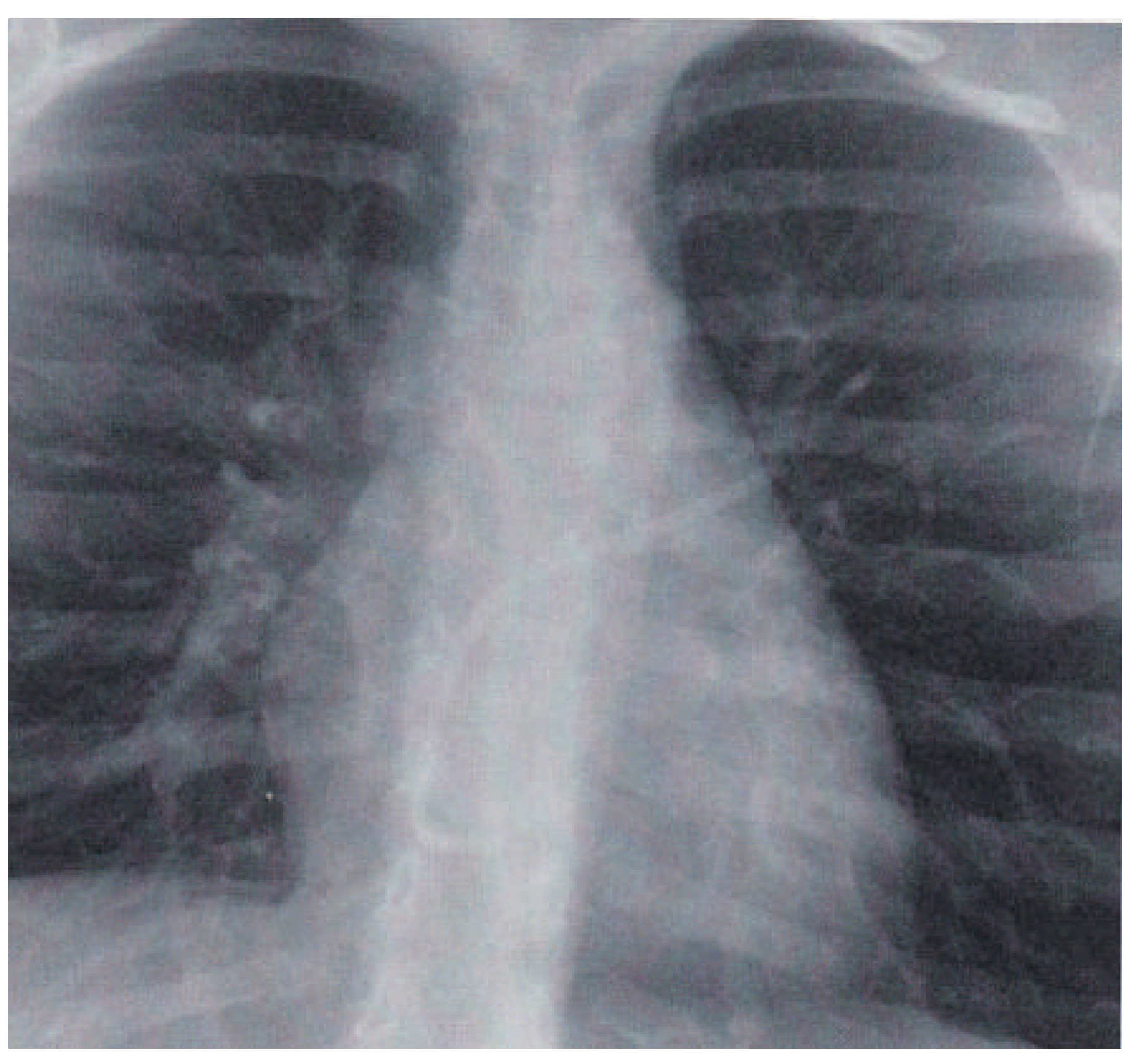 Cardiovascmed 19 00136 g002