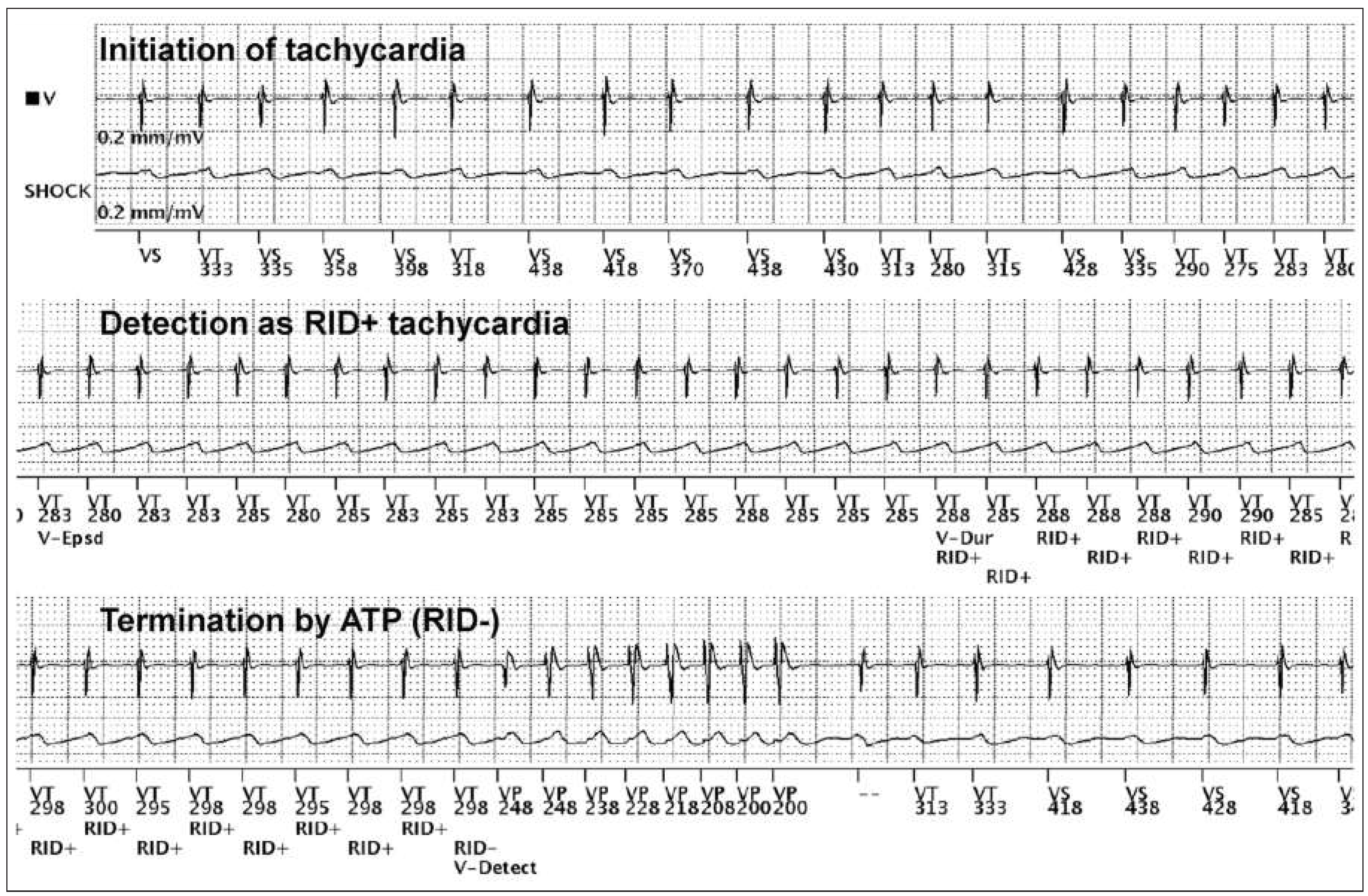 Cardiovascmed 19 00185 g001 Cardiovascmed 19 00185 g001