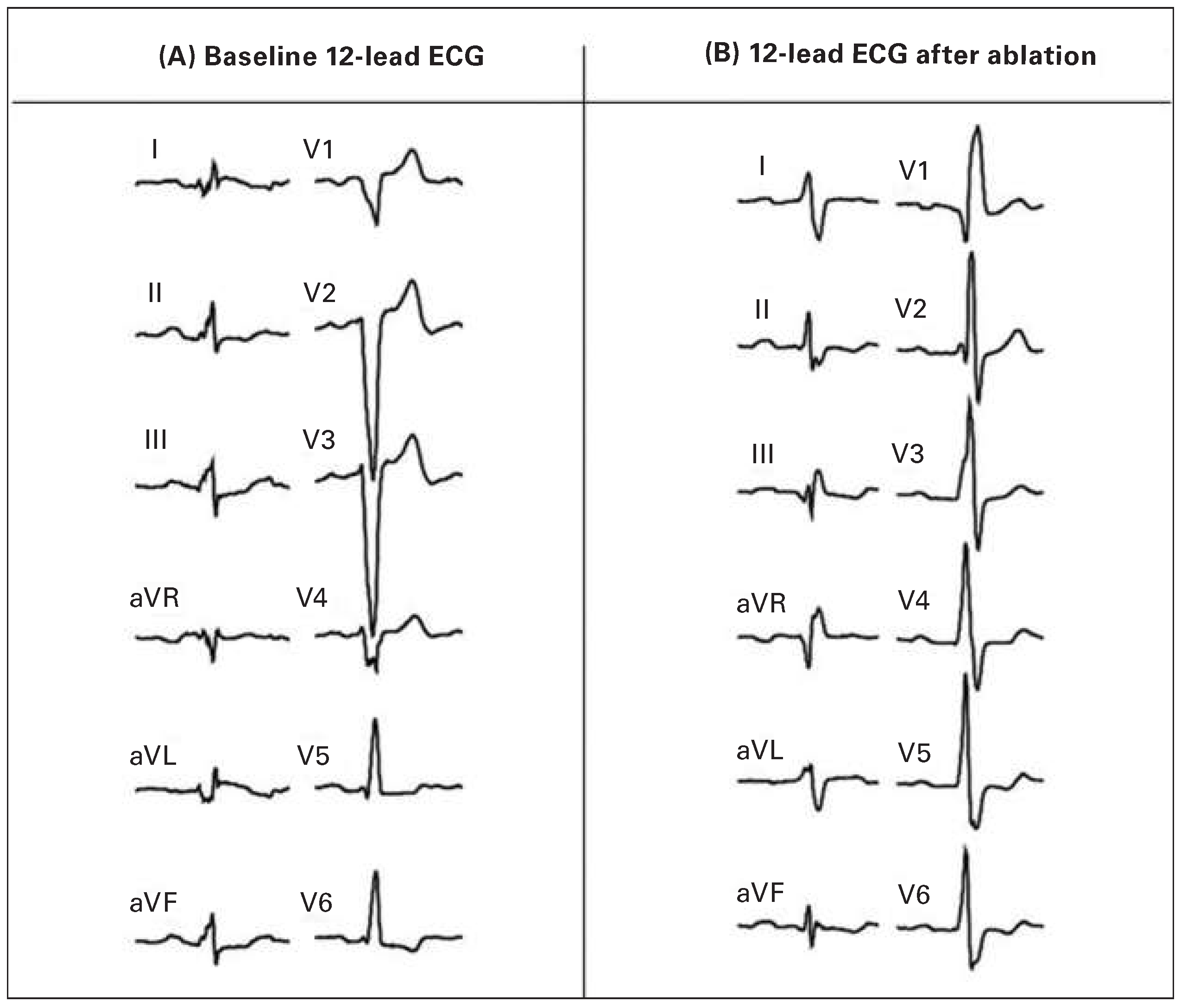 Cardiovascmed 19 00185 g002 Cardiovascmed 19 00185 g002