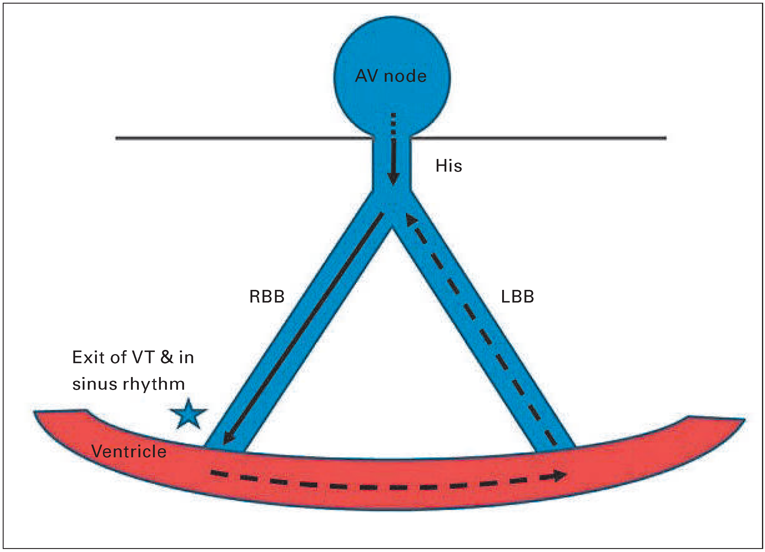 Cardiovascmed 19 00185 g003 Cardiovascmed 19 00185 g003
