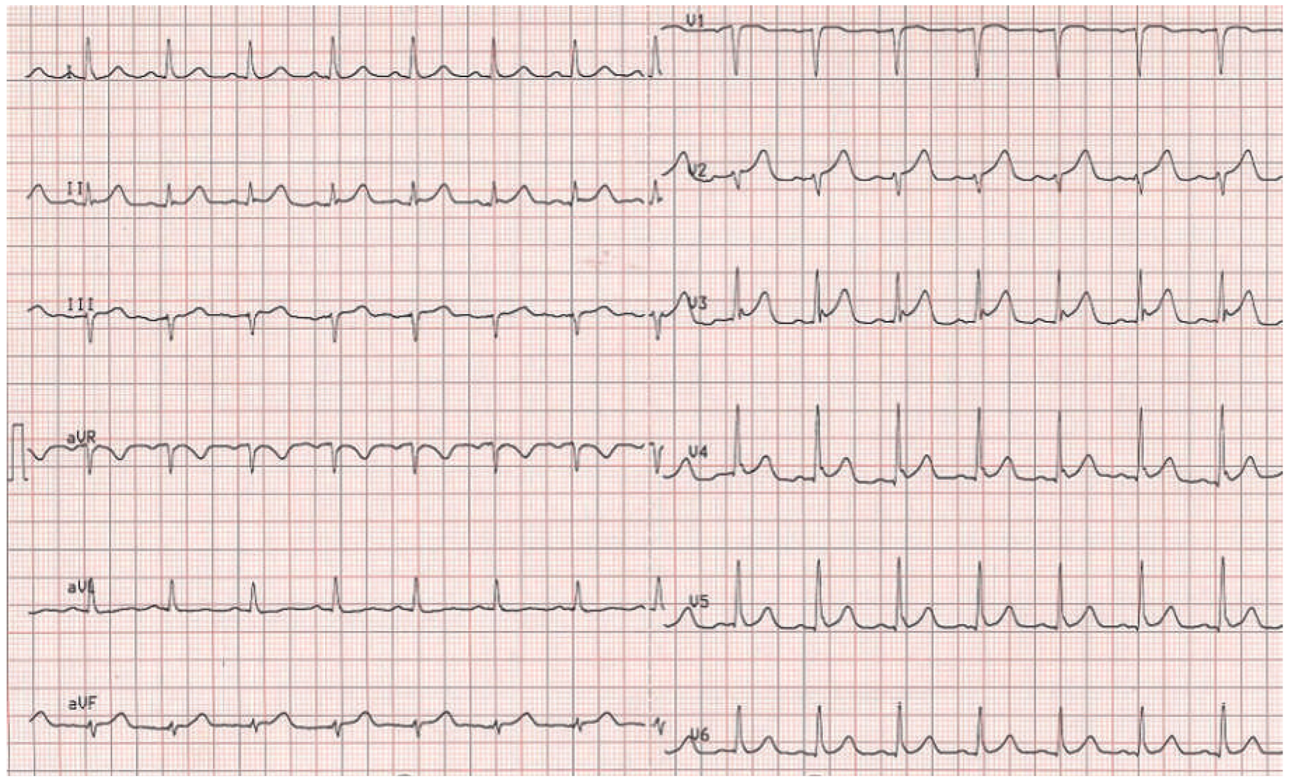 Cardiovascmed 19 00188 g001