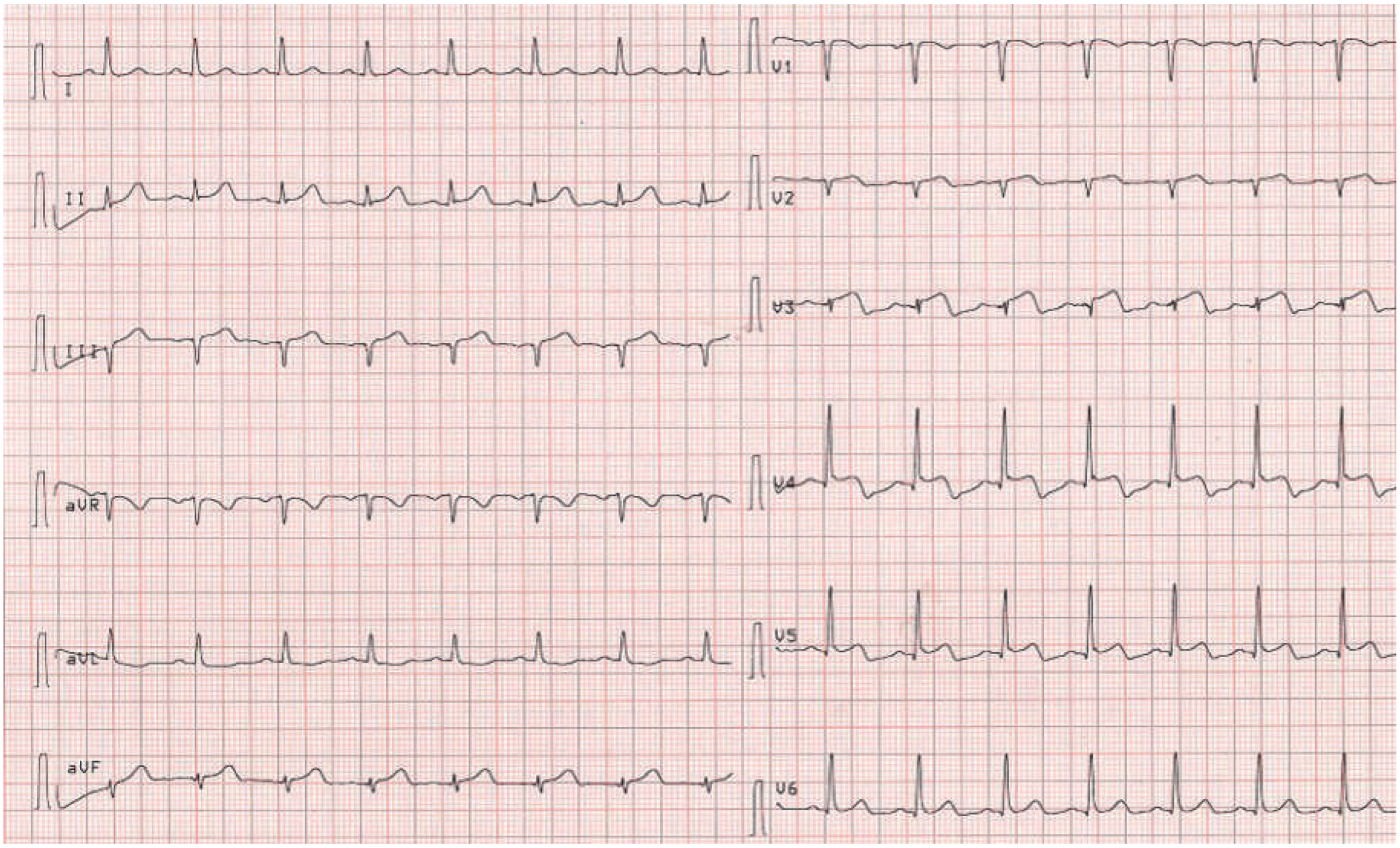 Cardiovascmed 19 00188 g002