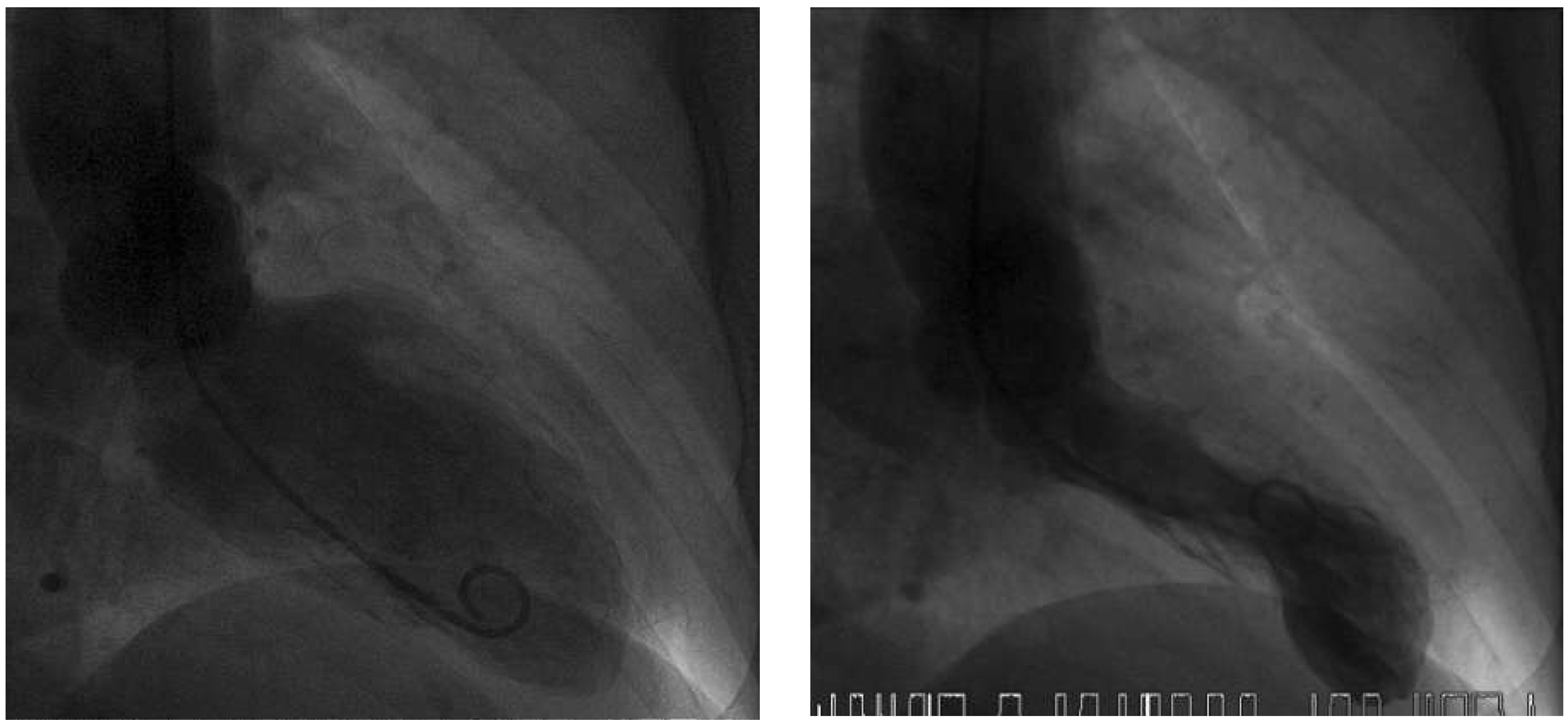 Cardiovascmed 19 00188 g003