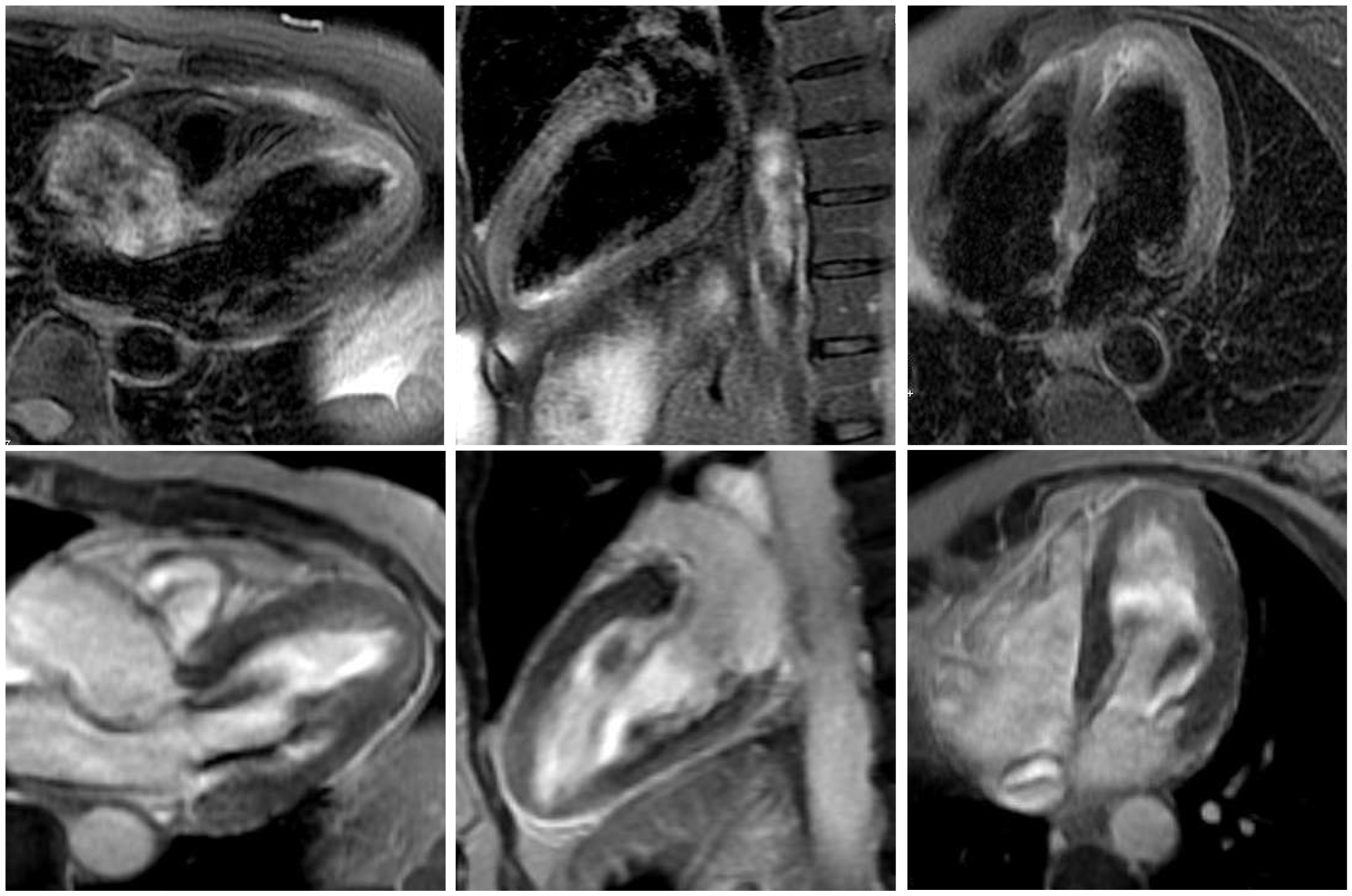 Cardiovascmed 19 00188 g004