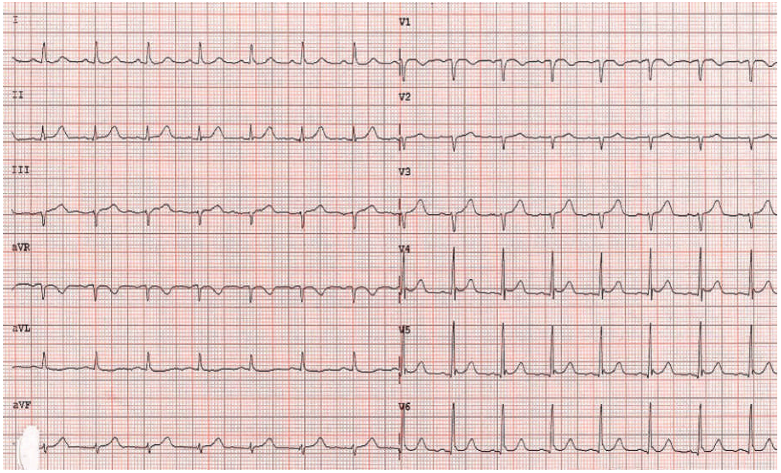 Cardiovascmed 19 00188 g005