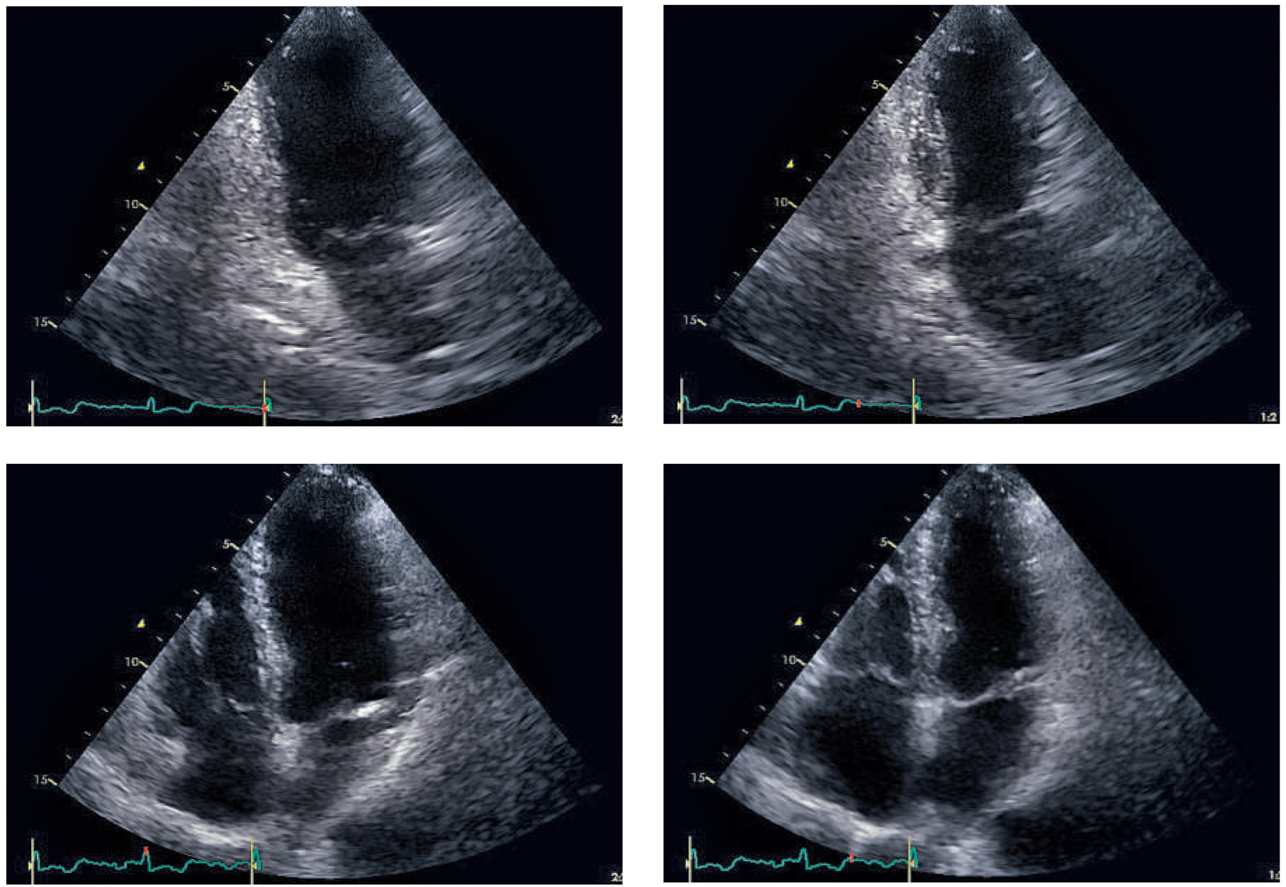 Cardiovascmed 19 00188 g006