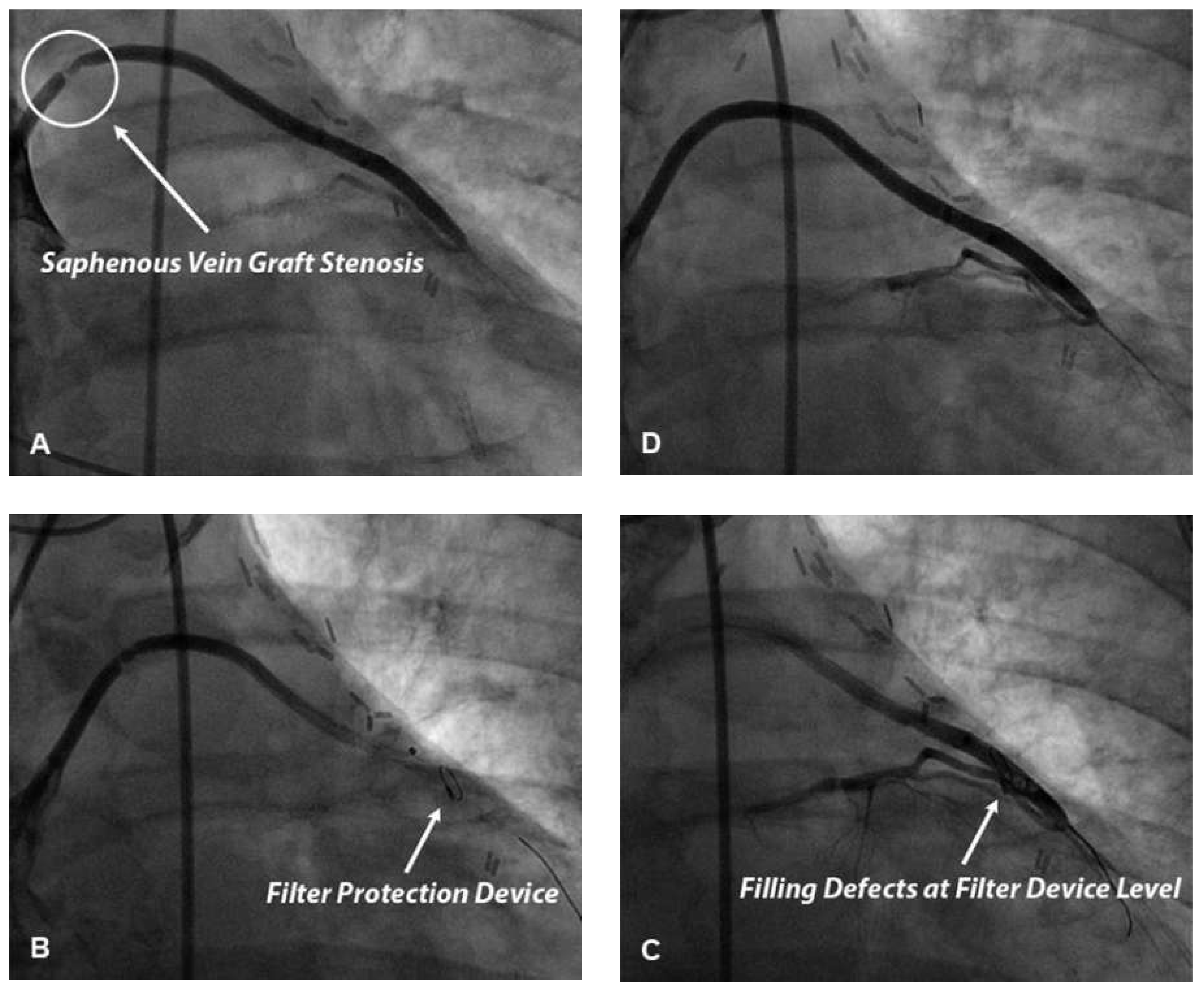 Cardiovascmed 19 00197 g003