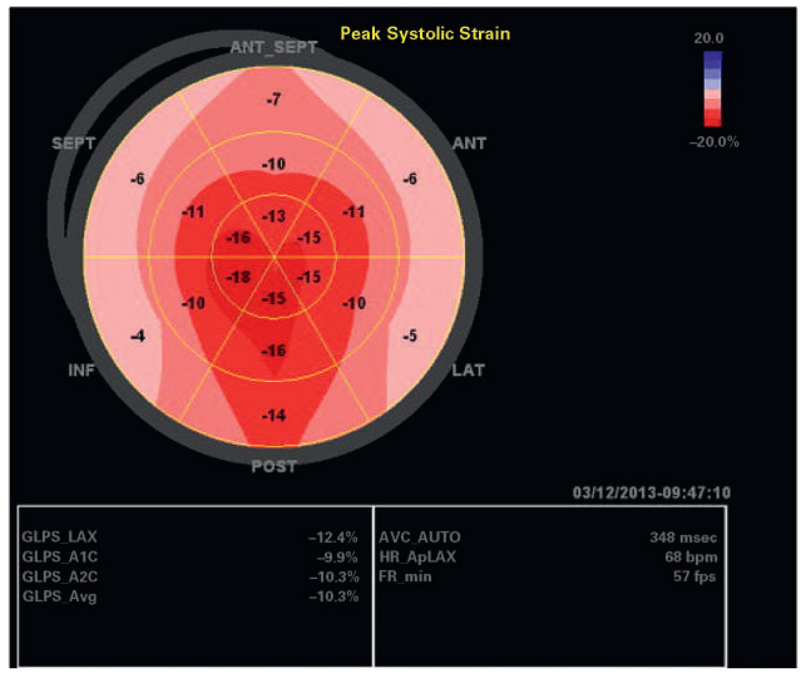 Cardiovascmed 19 00204 g003